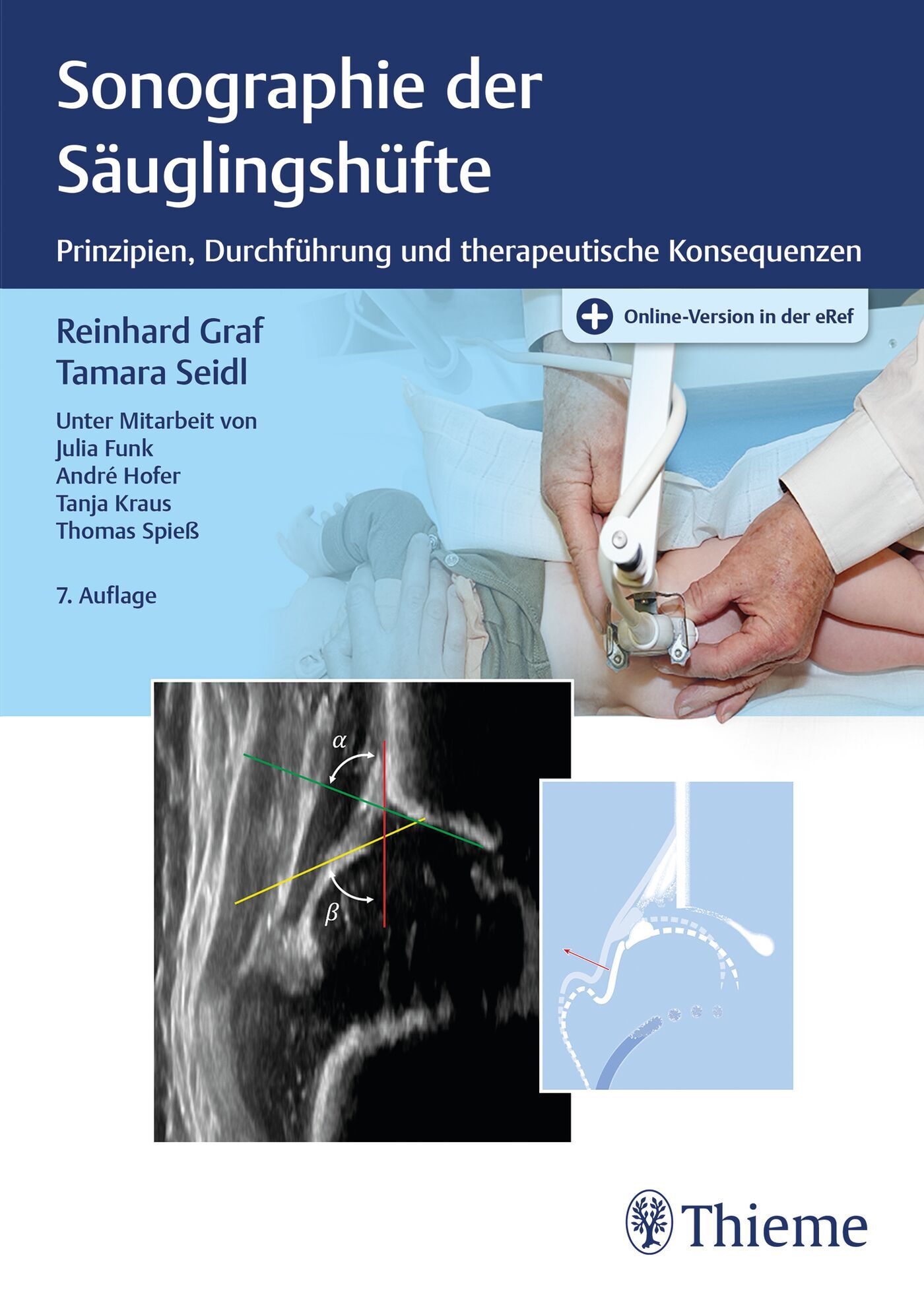 Sonographie der Säuglingshüfte, 9783132443525