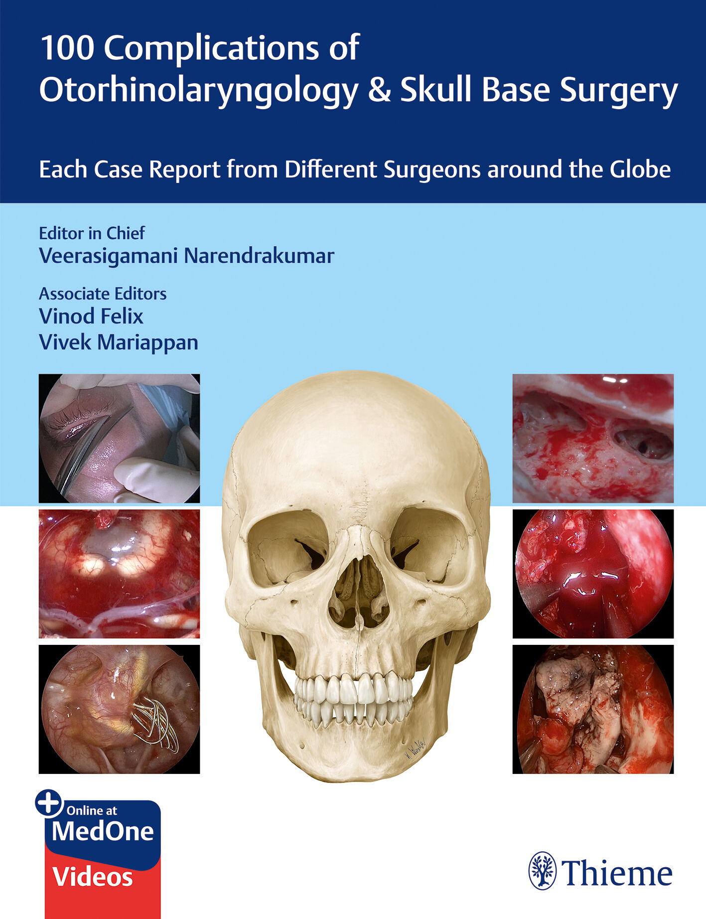 100 Complications of Otorhinolaryngology & Skull Base Surgery, 9789395390576