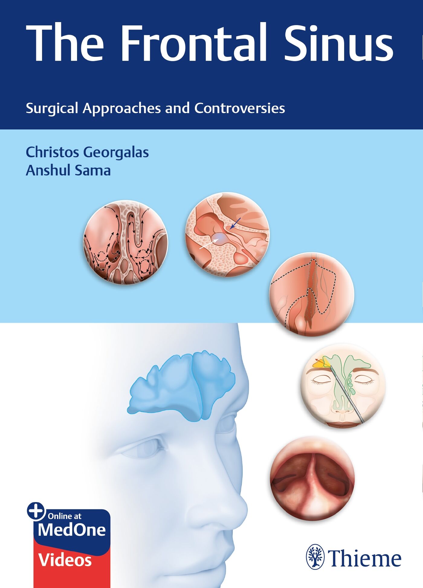 The Frontal Sinus, 9783132426696