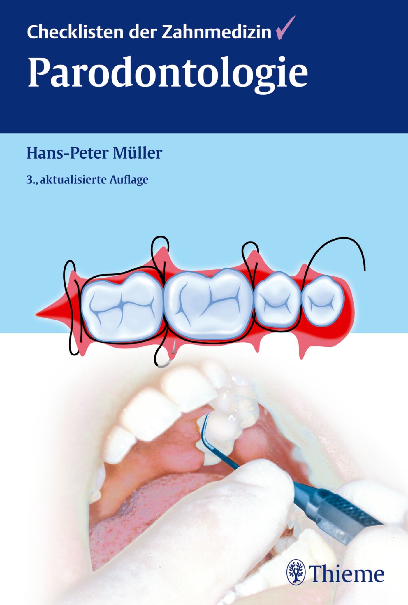 Checklisten der Zahnmedizin Parodontologie, 9783131699930