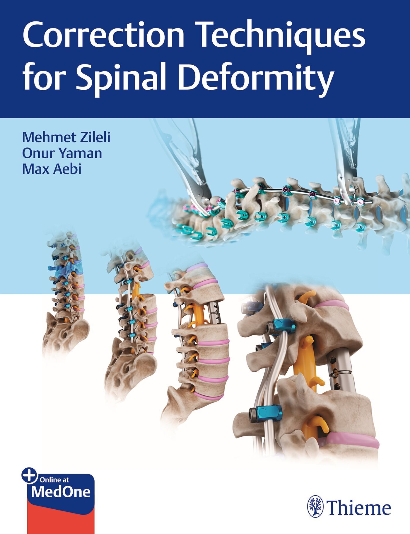 Correction Techniques for Spinal Deformity, 9789395390132