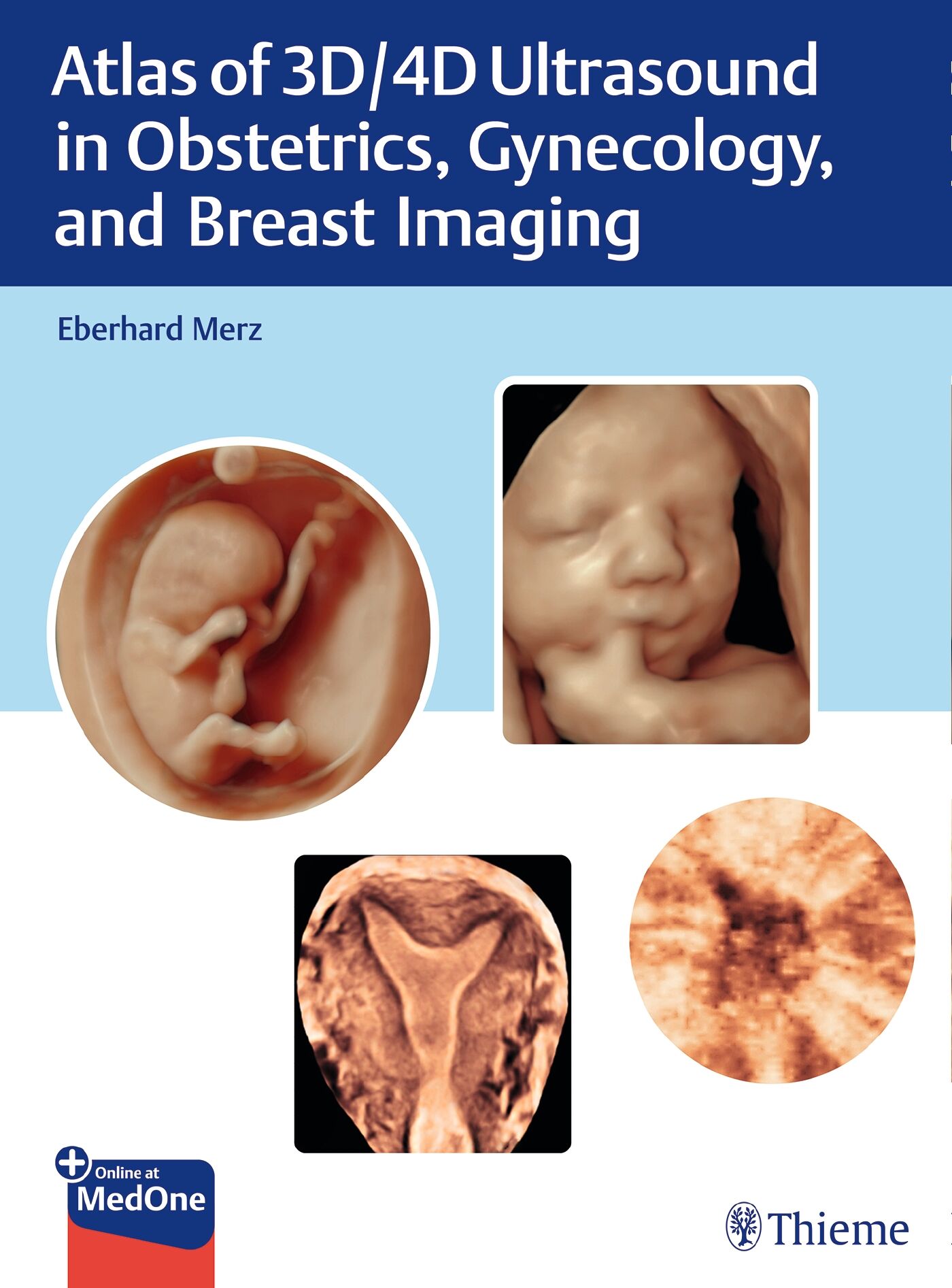 Atlas of 3D/4D Ultrasound in Obstetrics, Gynecology, and Breast Imaging, 9783131764317