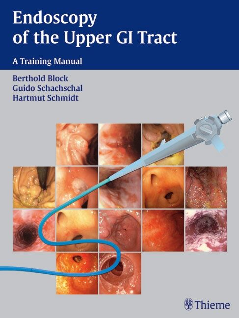 Endoscopy of the Upper GI Tract, 9783131367310