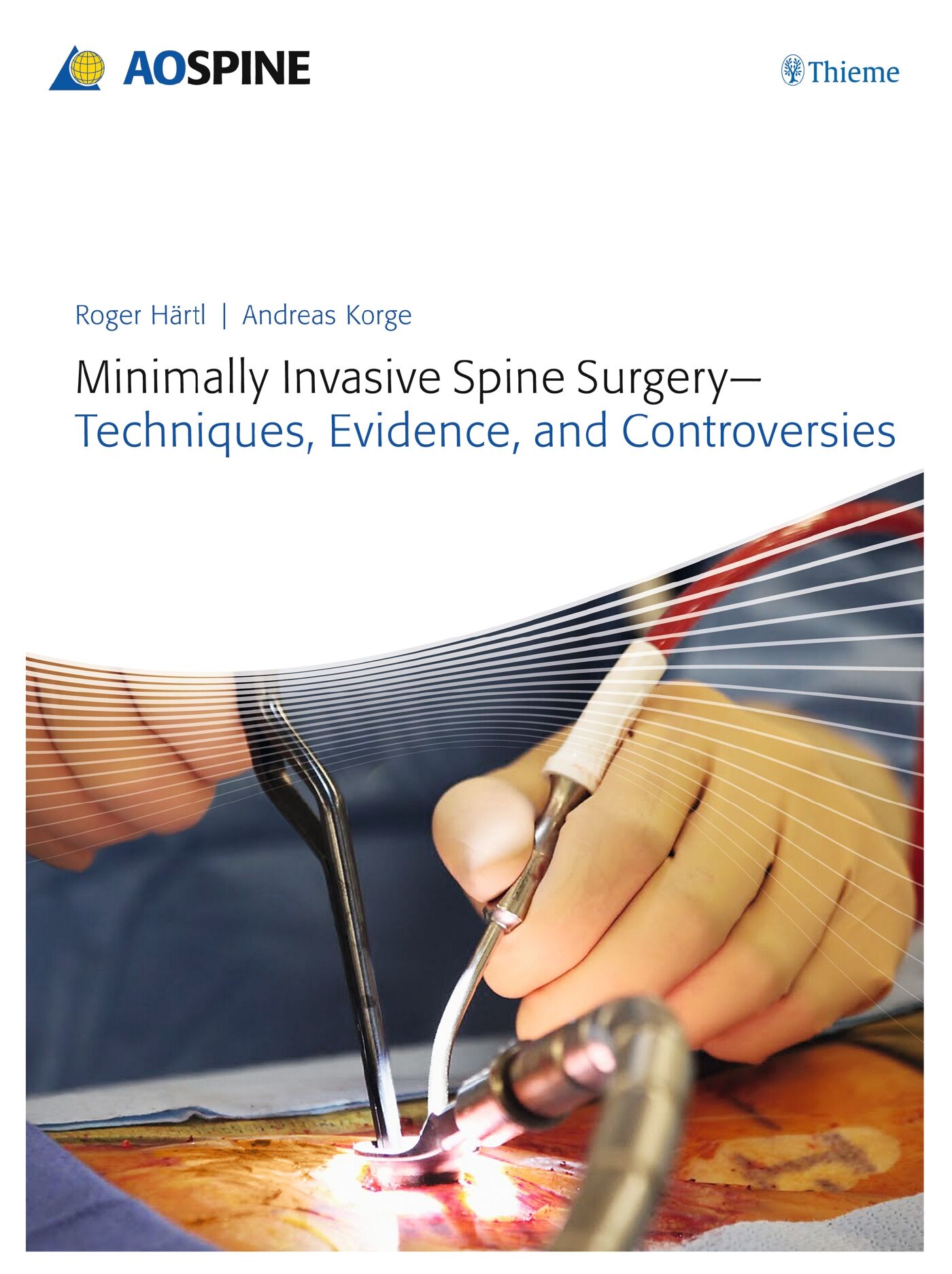 Minimally Invasive Spine Surgery - Techniques, Evidence, and Controversies, 9783131723819