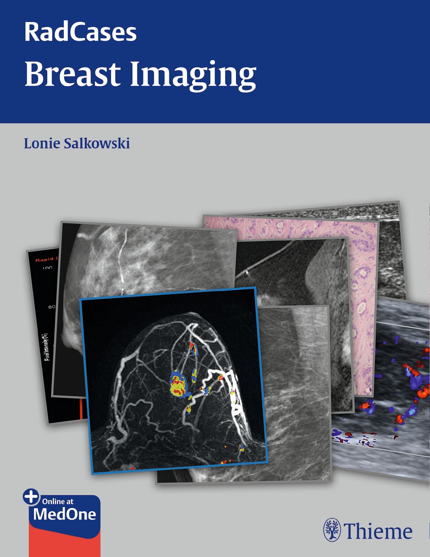 Radcases Breast Imaging, 9781604061918