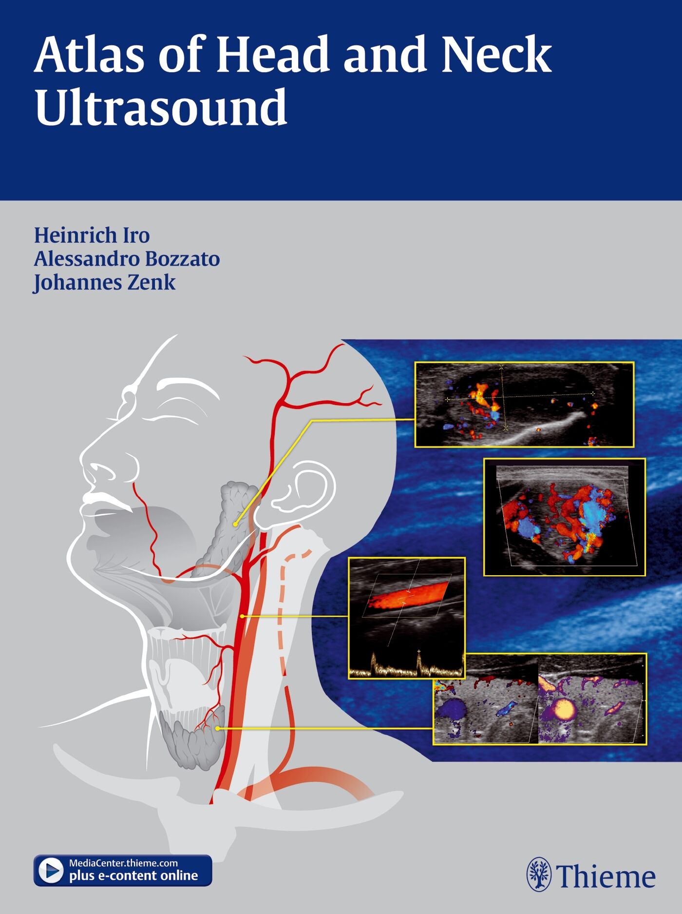 Atlas of Head and Neck Ultrasound, 9783131603517