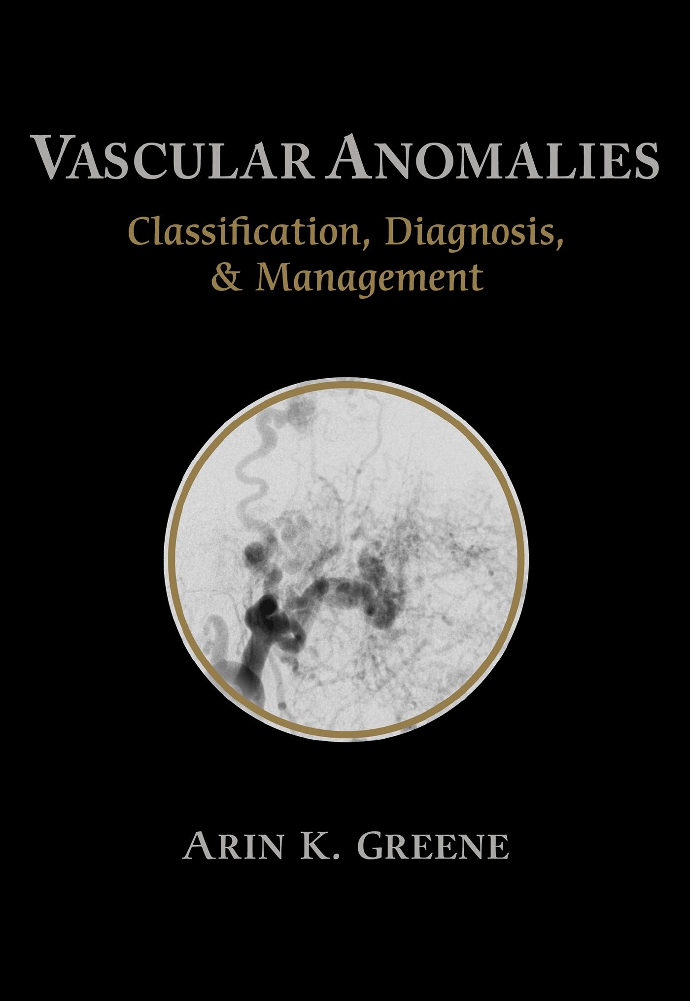 Vascular Anomalies, 9781626235922