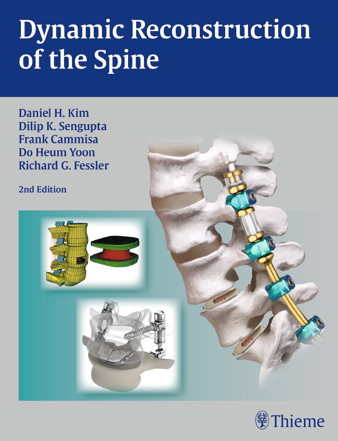 Dynamic Reconstruction of the Spine, 9781604068733