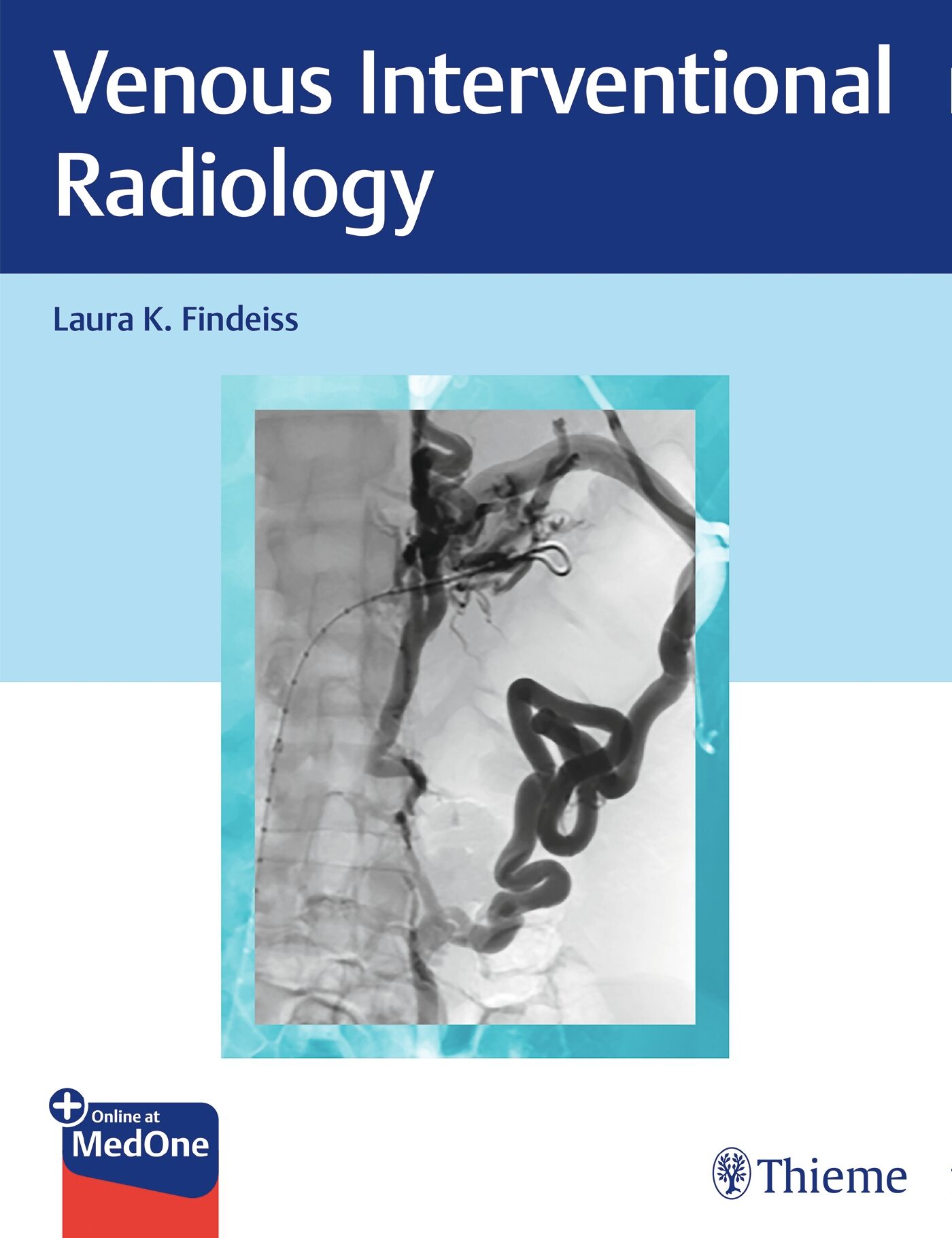 Venous Interventional Radiology, 9781626232730