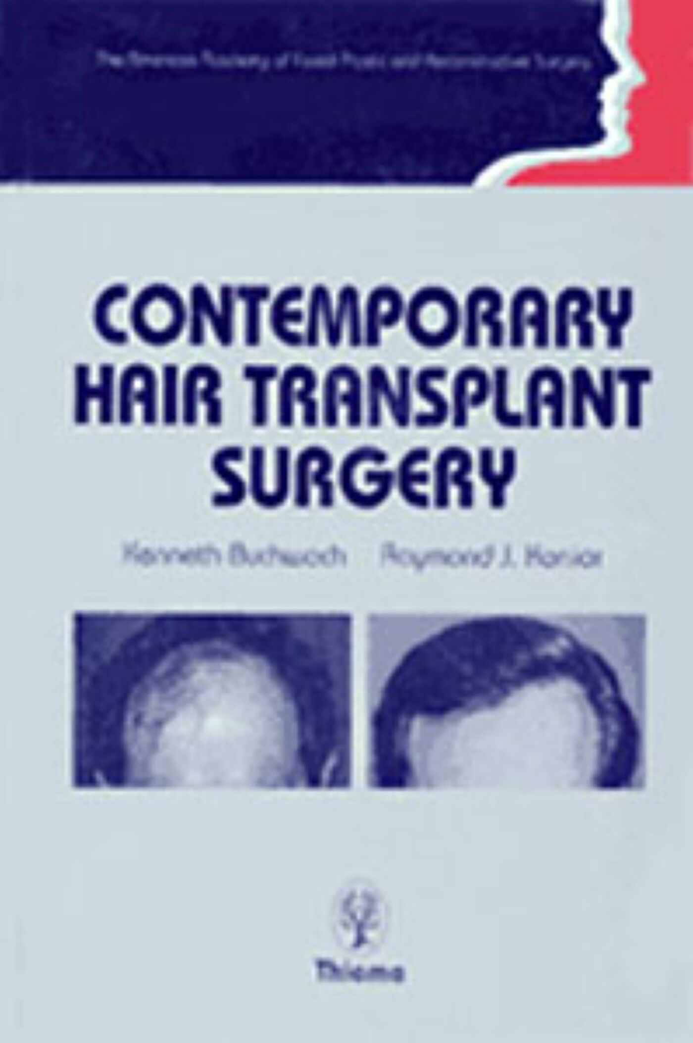 Contemporary Hair Transplant Surgery, 9780865775770