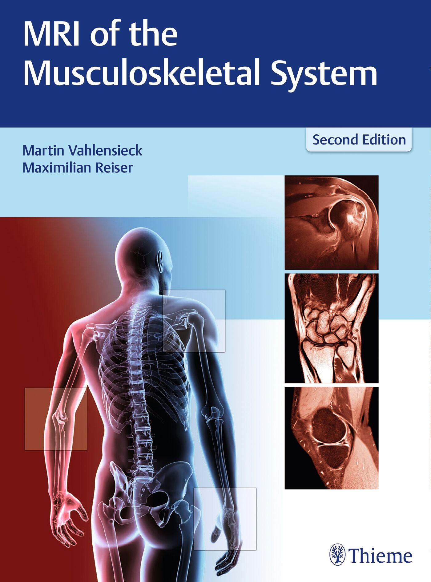 MRI of the Musculoskeletal System, 9783131165725