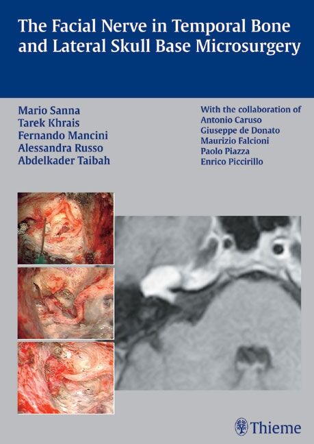 The Facial Nerve in Temporal Bone and Lateral Skull Base Microsurgery, 9783132581388