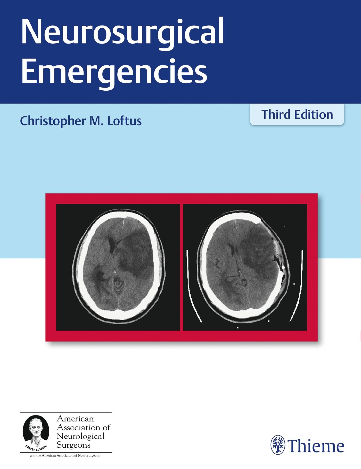 Neurosurgical Emergencies, 9781626233331
