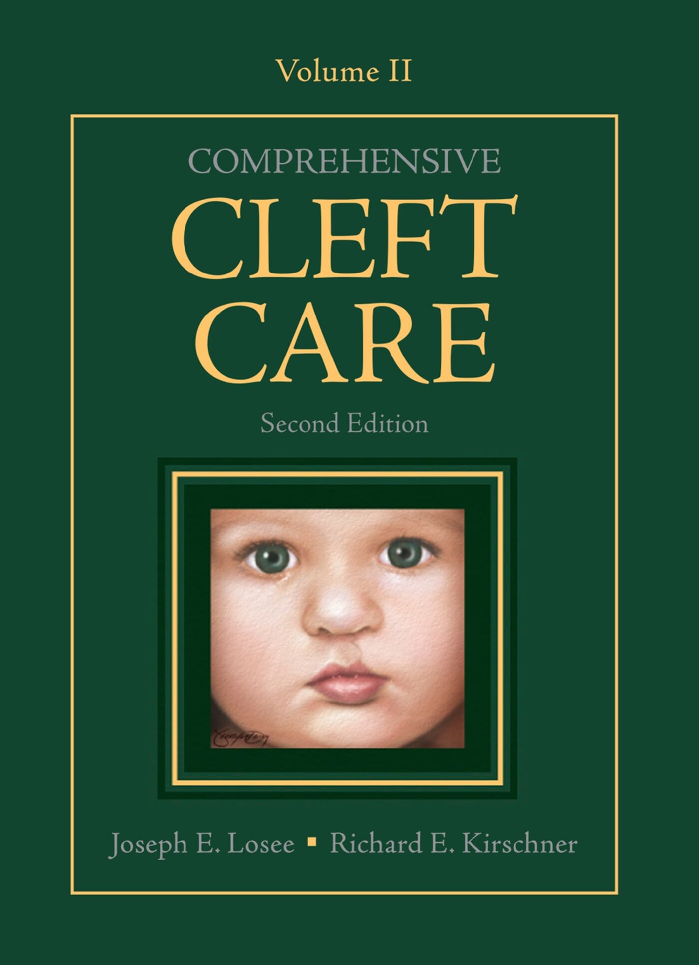 Comprehensive Cleft Care, Second Edition: Volume Two, 9781626236660