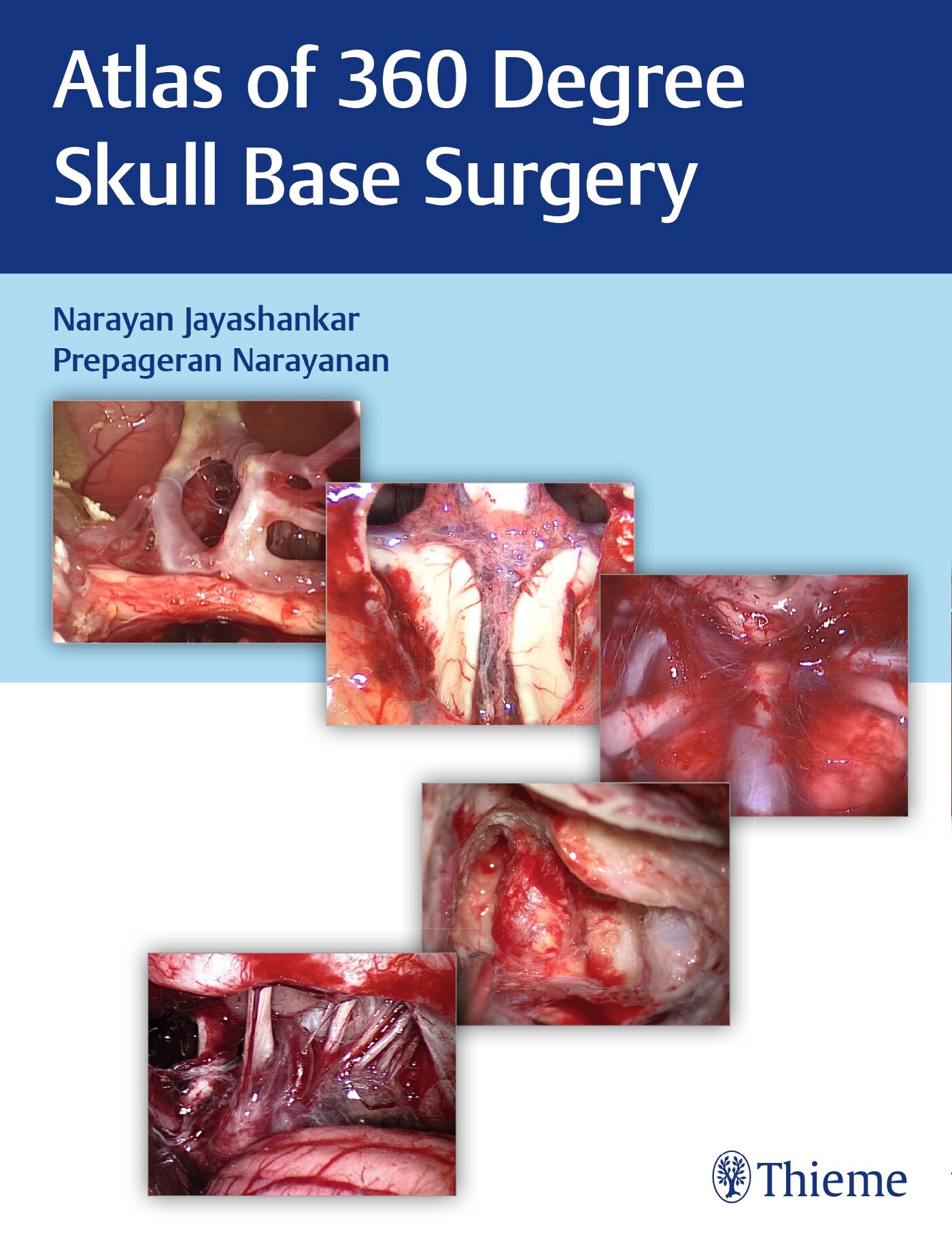 Atlas of 360 Degree Skull Base Surgery, 9789390553136