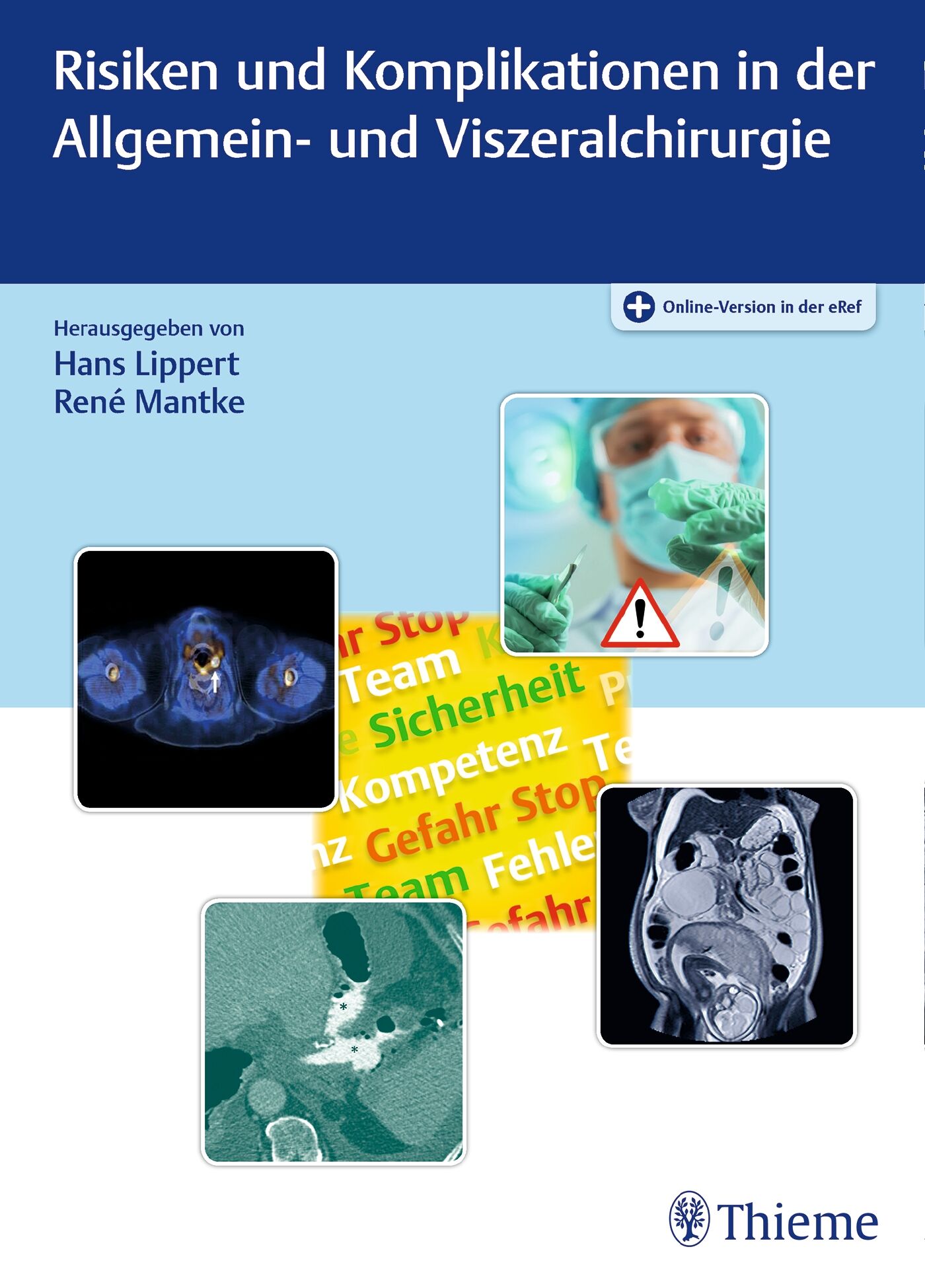 Risiken und Komplikationen in der Allgemein- und Viszeralchirurgie, 9783132418790