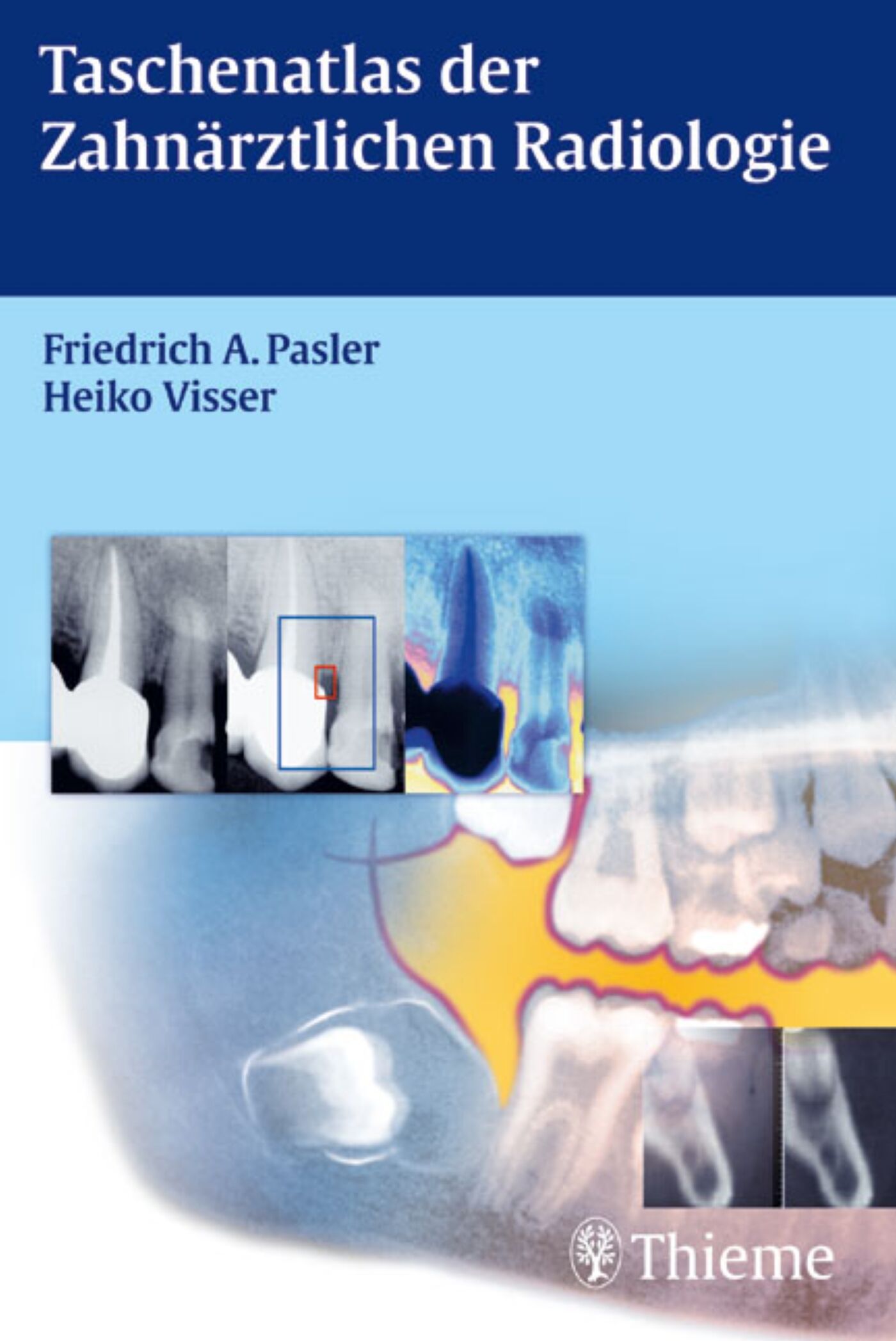Taschenatlas der Zahnärztlichen Radiologie, 9783131580511