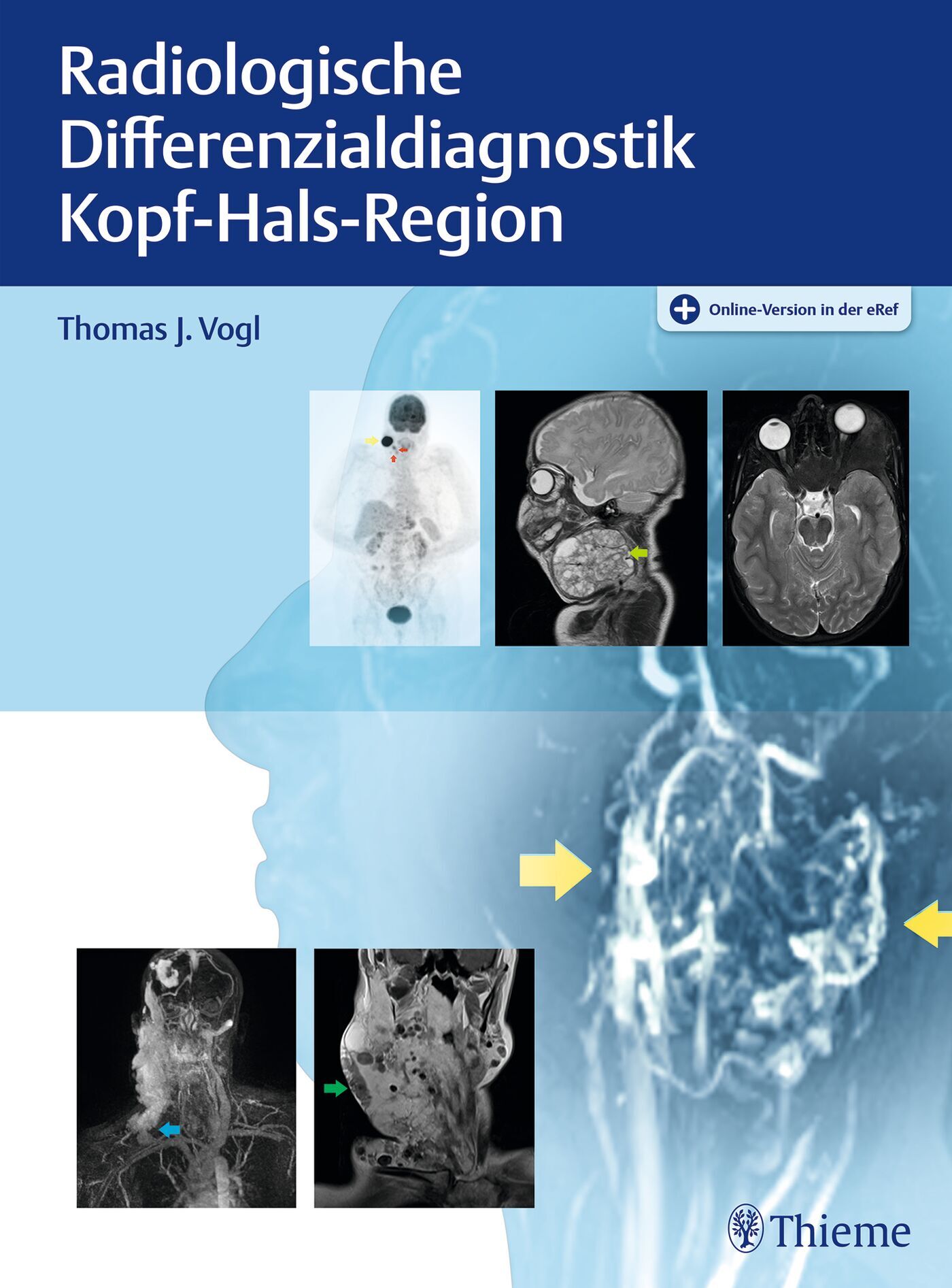 Radiologische Differenzialdiagnostik Kopf-Hals-Region, 9783132414891