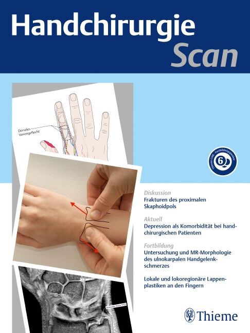 Handchirurgie Scan, 2194-8976