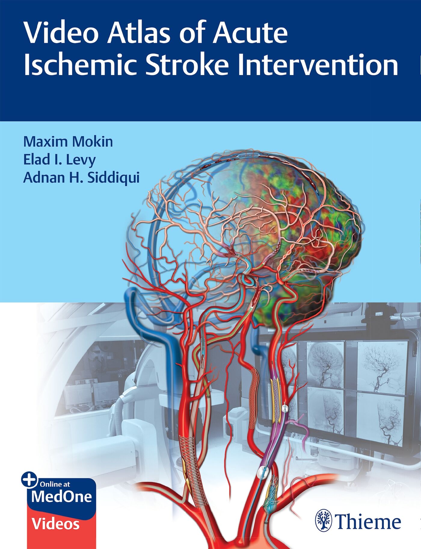 Video Atlas of Acute Ischemic Stroke Intervention, 9781684202492