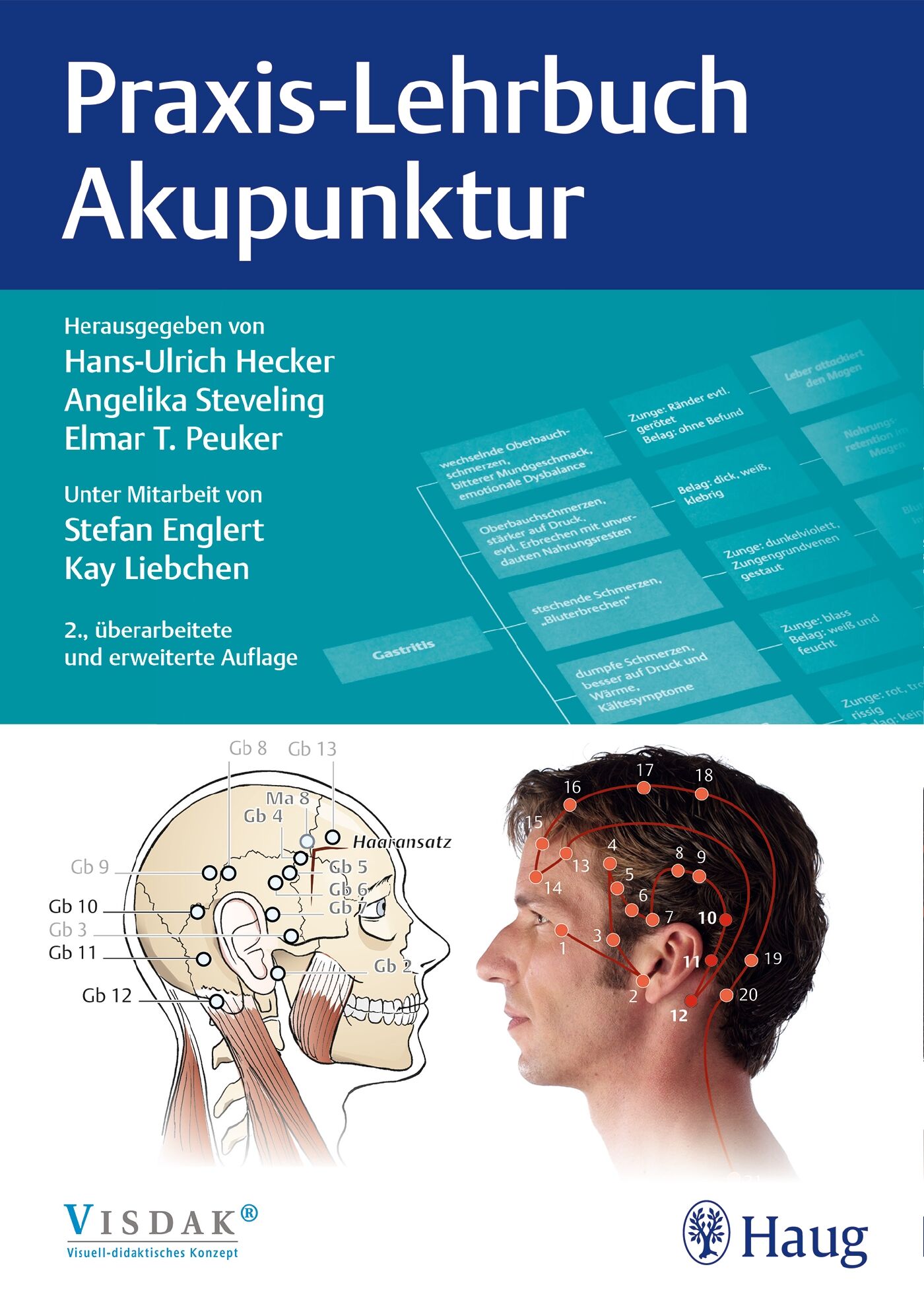 Praxis-Lehrbuch Akupunktur, 9783132400252