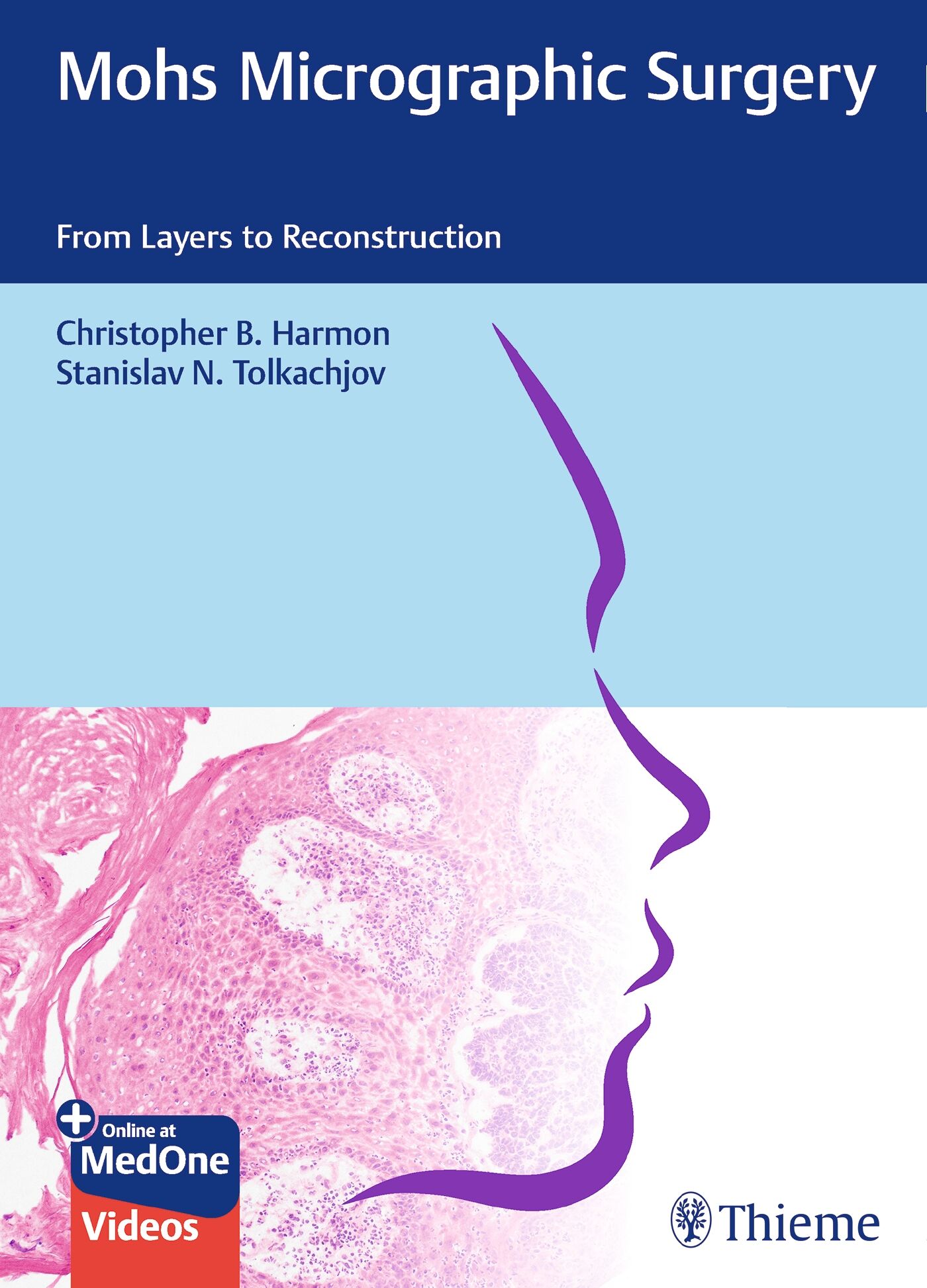 Mohs Micrographic Surgery: From Layers to Reconstruction, 9783132420182