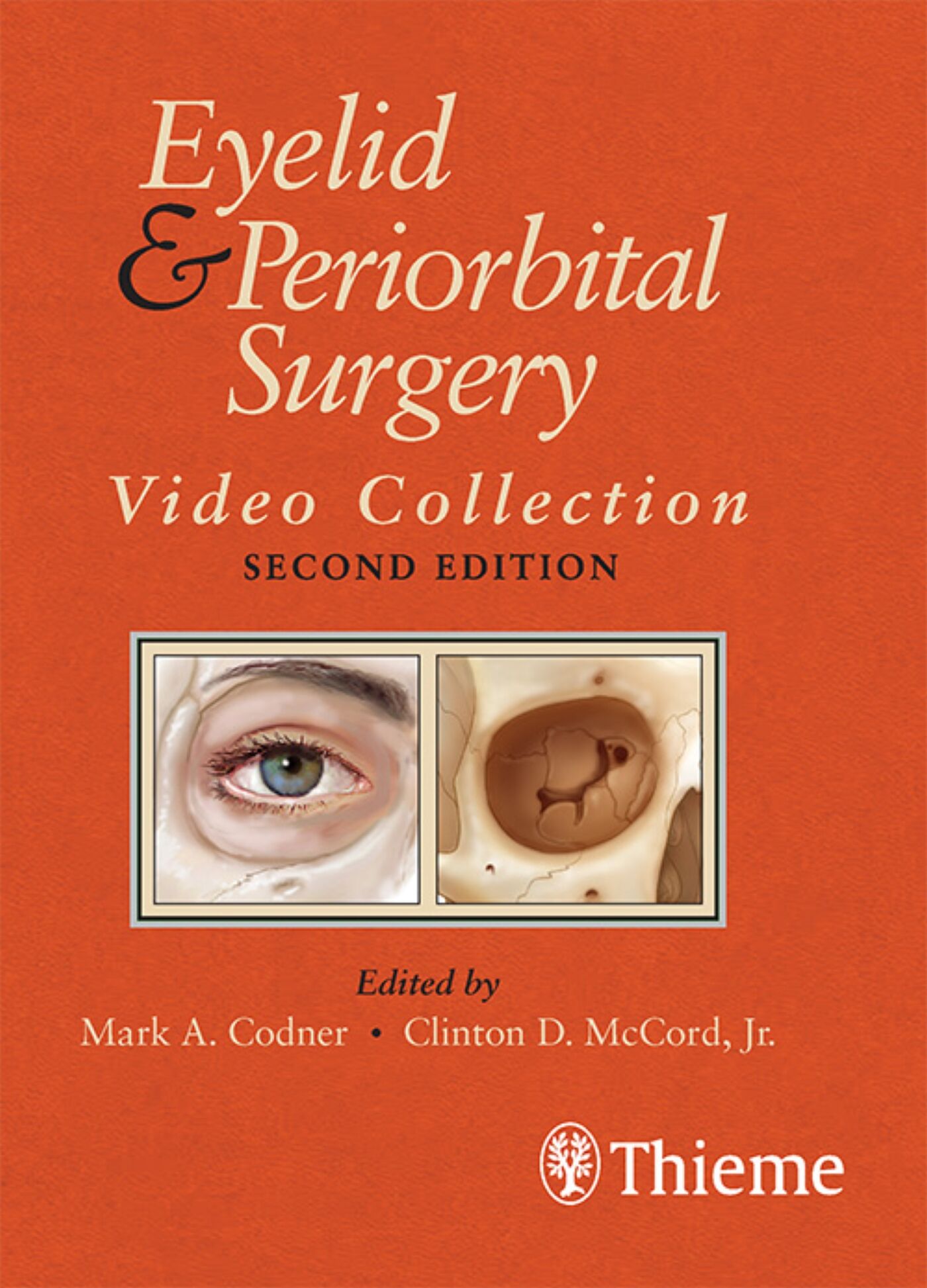 Eyelid and Periorbital Surgery Video Collection, 9781626237438