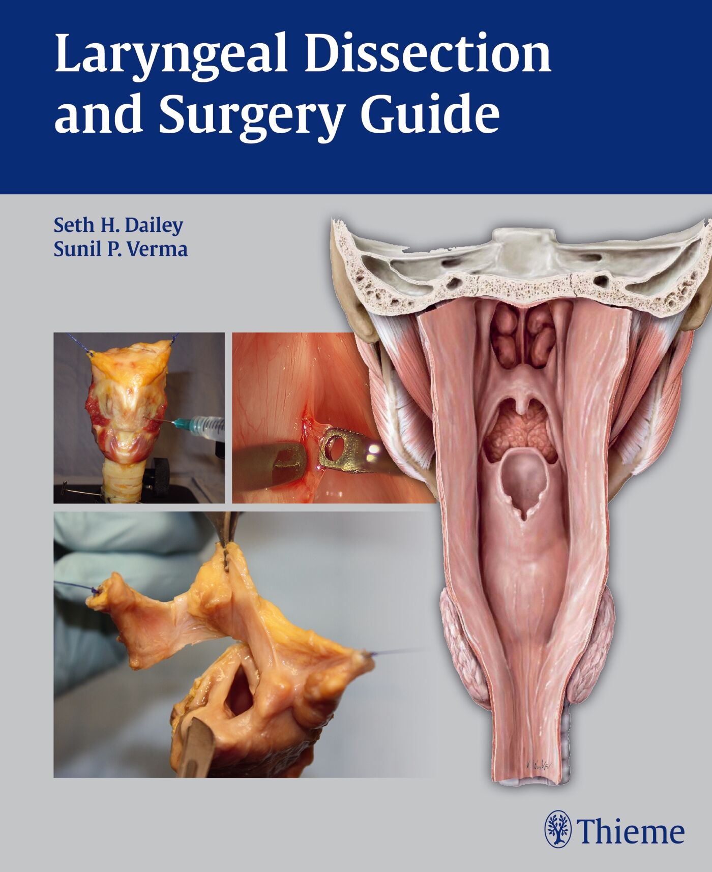Laryngeal Dissection and Surgery Guide, 9781604065695