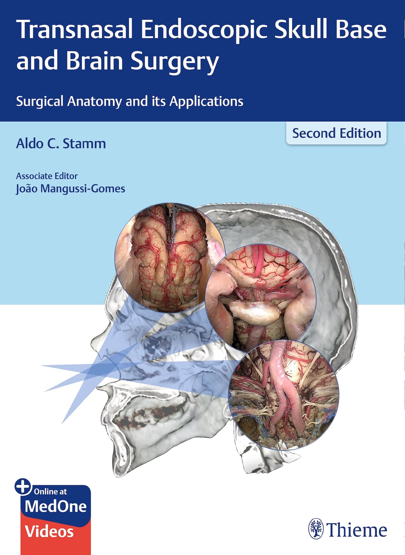 Transnasal Endoscopic Skull Base and Brain Surgery, 9781626237100