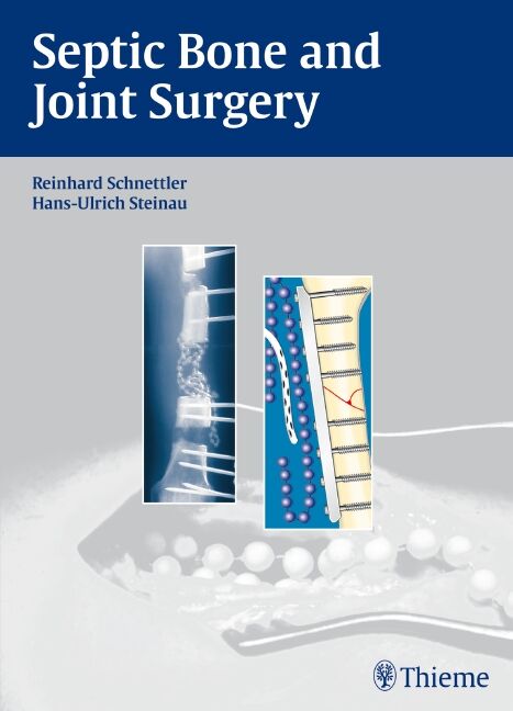 Septic Bone and Joint Surgery, 9783131490315