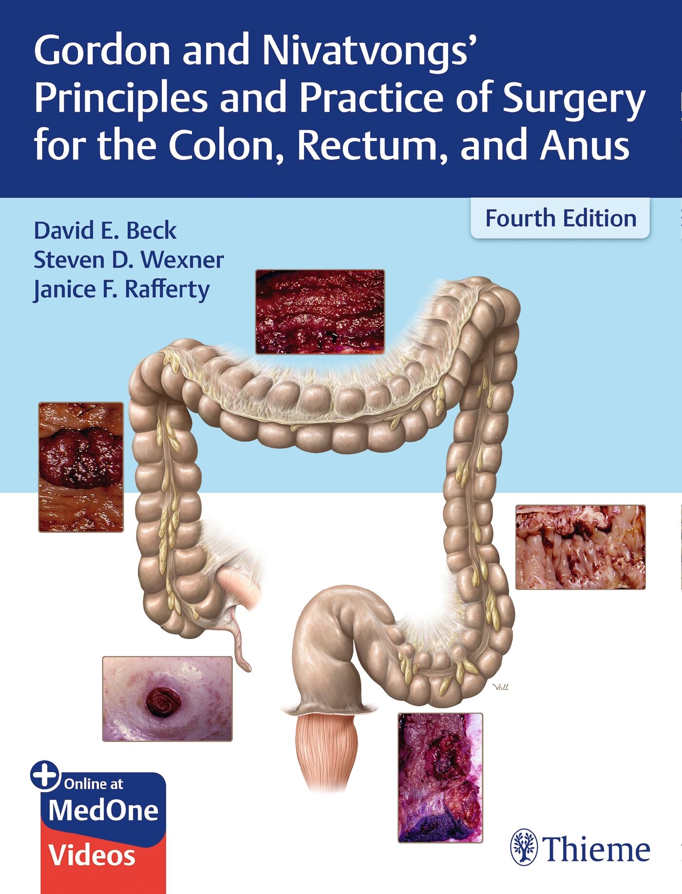 Gordon and Nivatvongs' Principles and Practice of Surgery for the Colon, Rectum, and Anus, 9781626234291