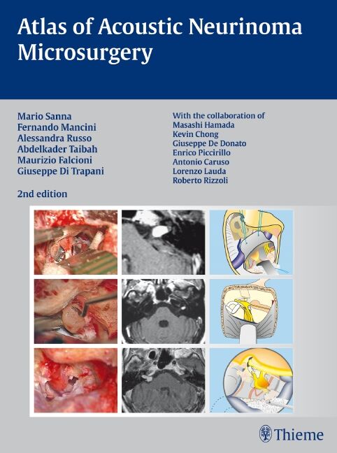 Atlas of Acoustic Neurinoma Microsurgery, 9783131102829