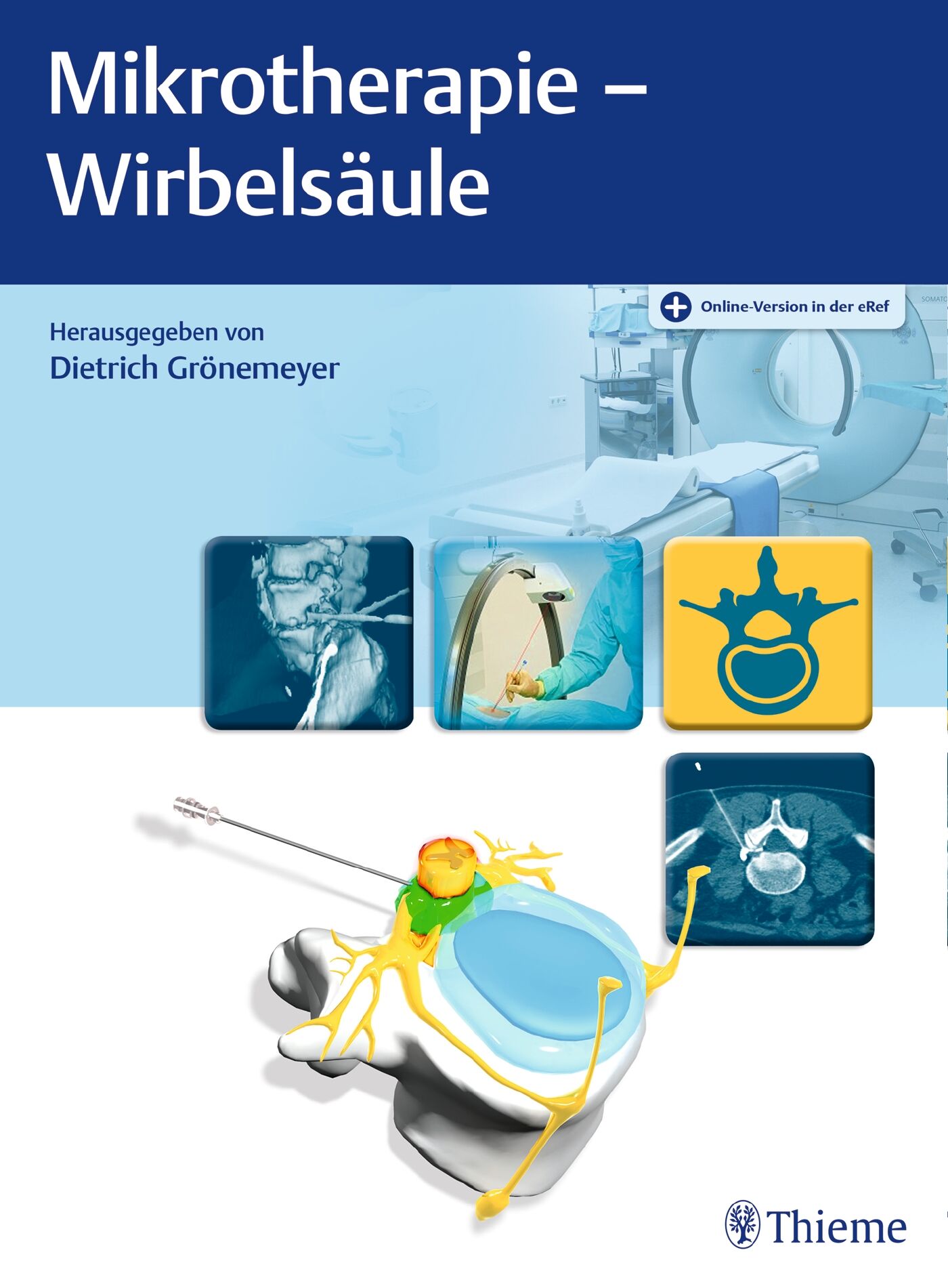 Mikrotherapie - Wirbelsäule, 9783132416697