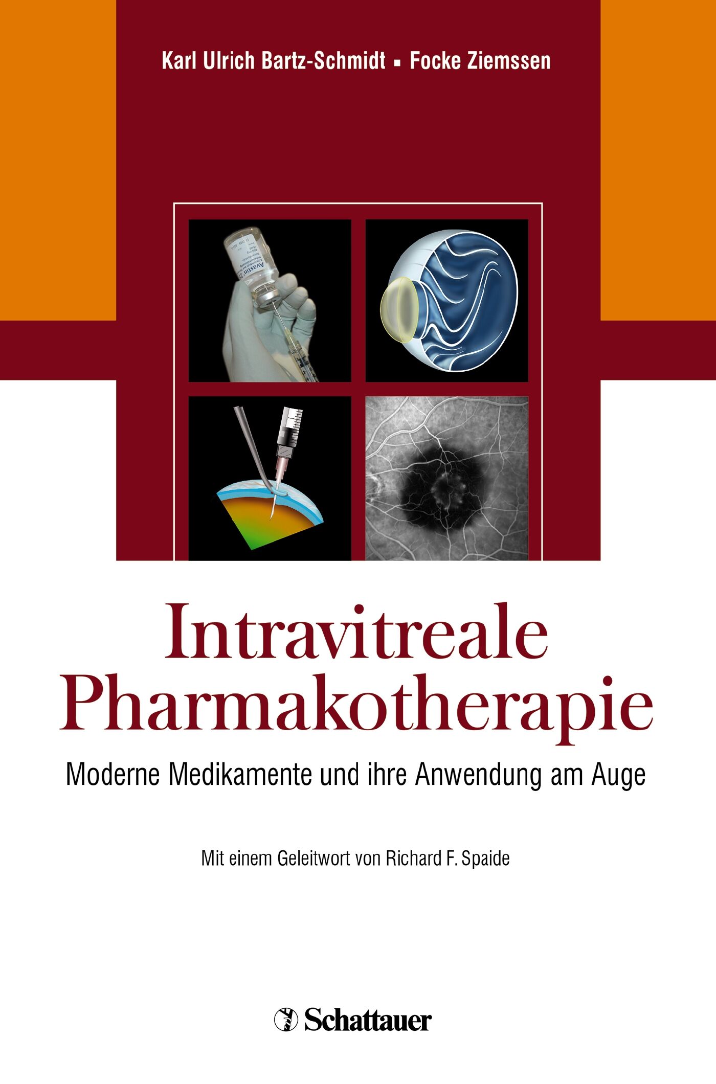 Intravitreale Pharmakotherapie, 9783794564637