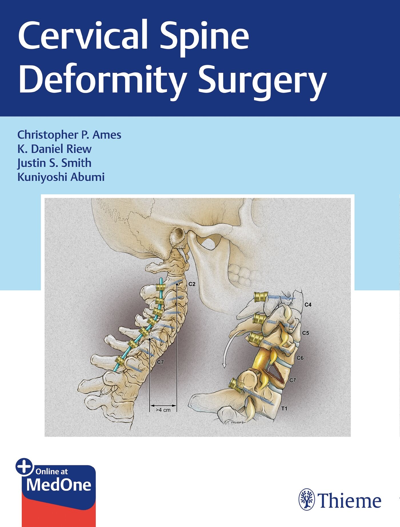 Cervical Spine Deformity Surgery, 9781626239012