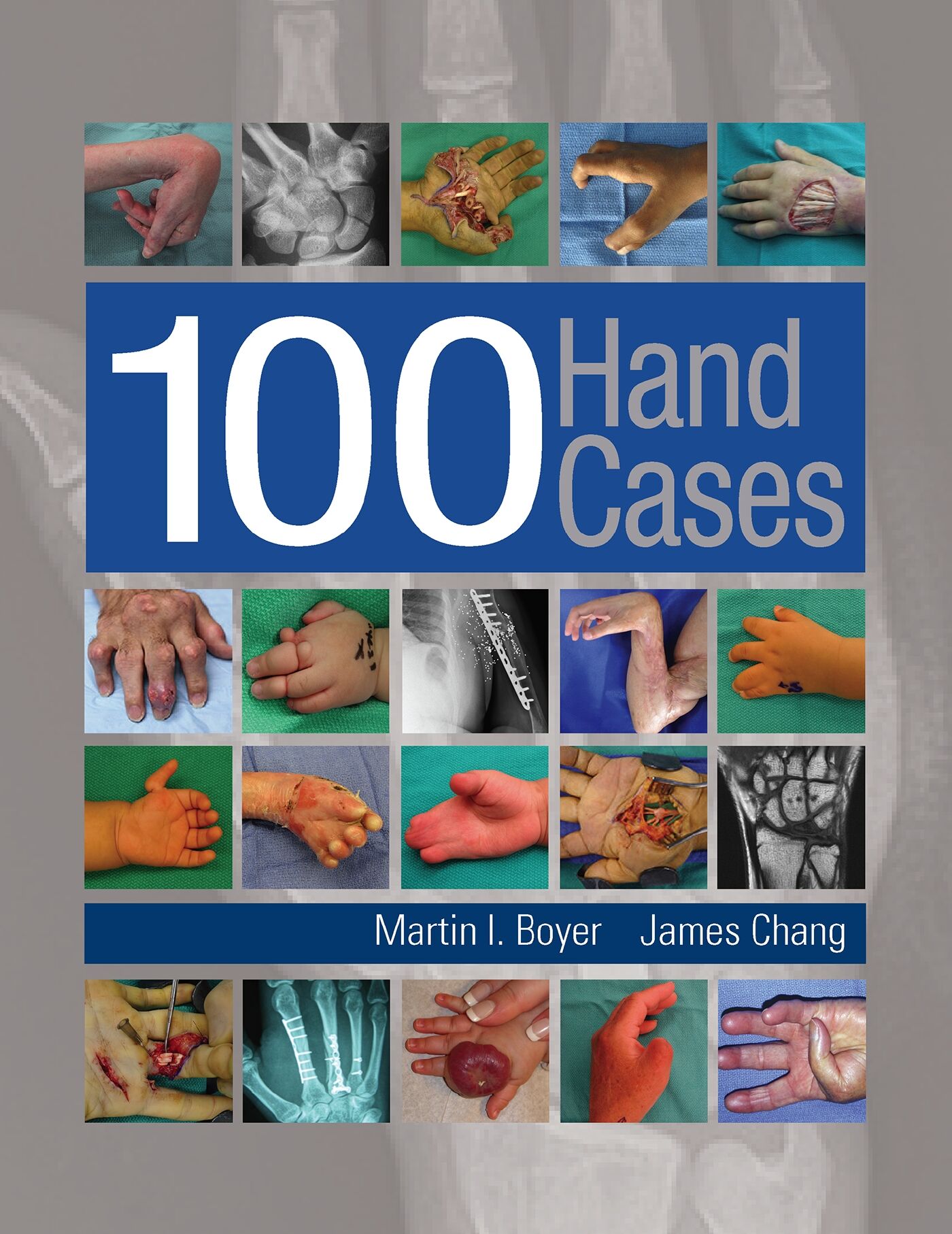 100 Hand Cases, 9781626236608