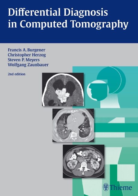 Differential Diagnosis in Computed Tomography, 9783131025425