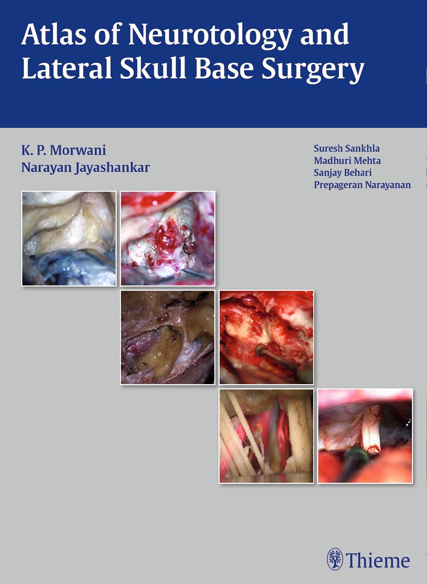 Atlas of Neurotology and Lateral Skull Base Surgery, 9789382076933