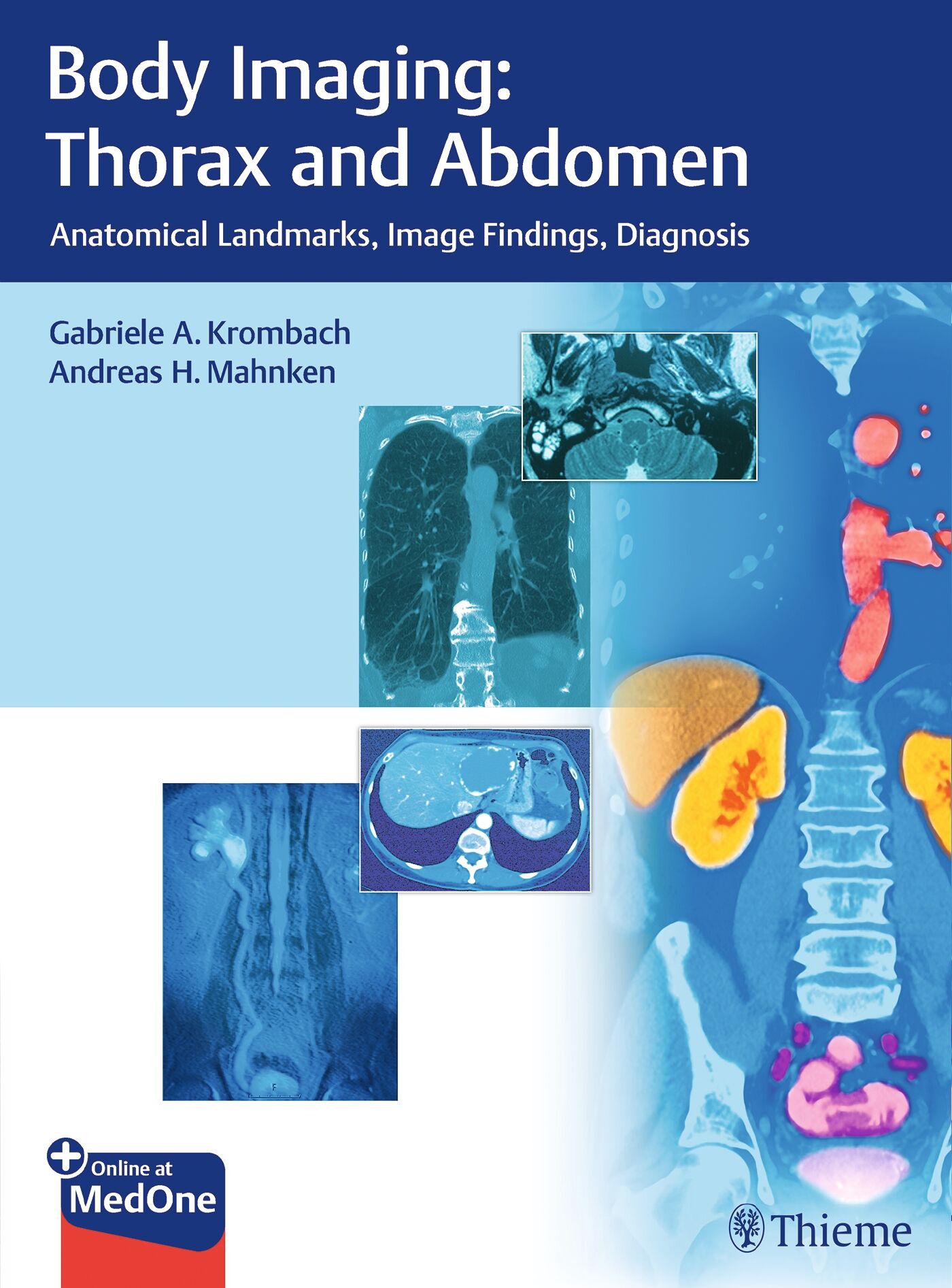 Body Imaging: Thorax and Abdomen, 9783132054110