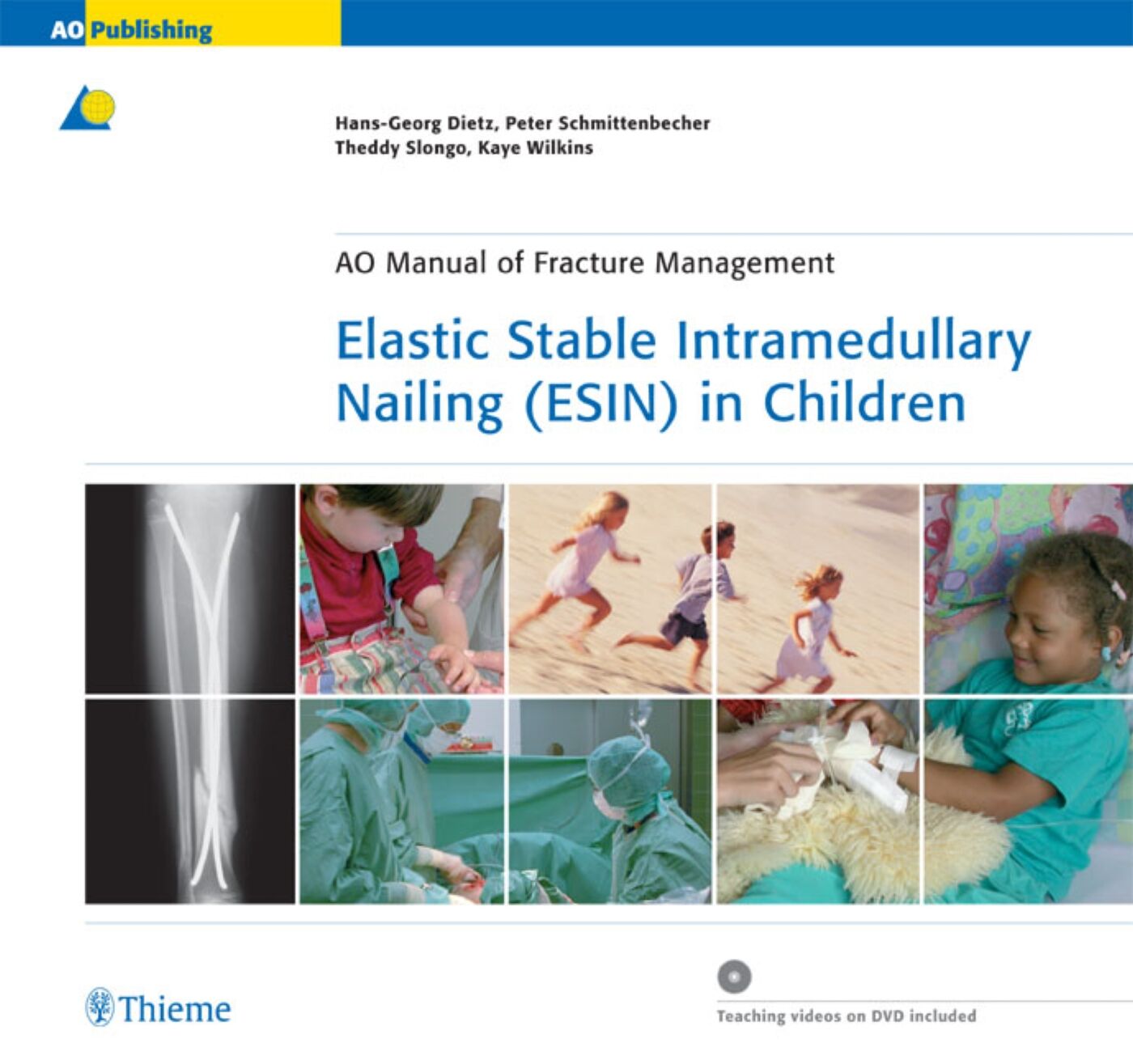 Elastic Stable Intramedullary Nailing (ESIN) in Children, 9783131649515