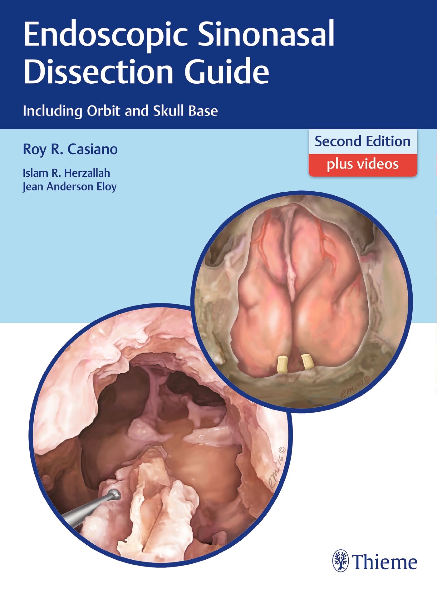 Endoscopic Sinonasal Dissection Guide, 9781626232105