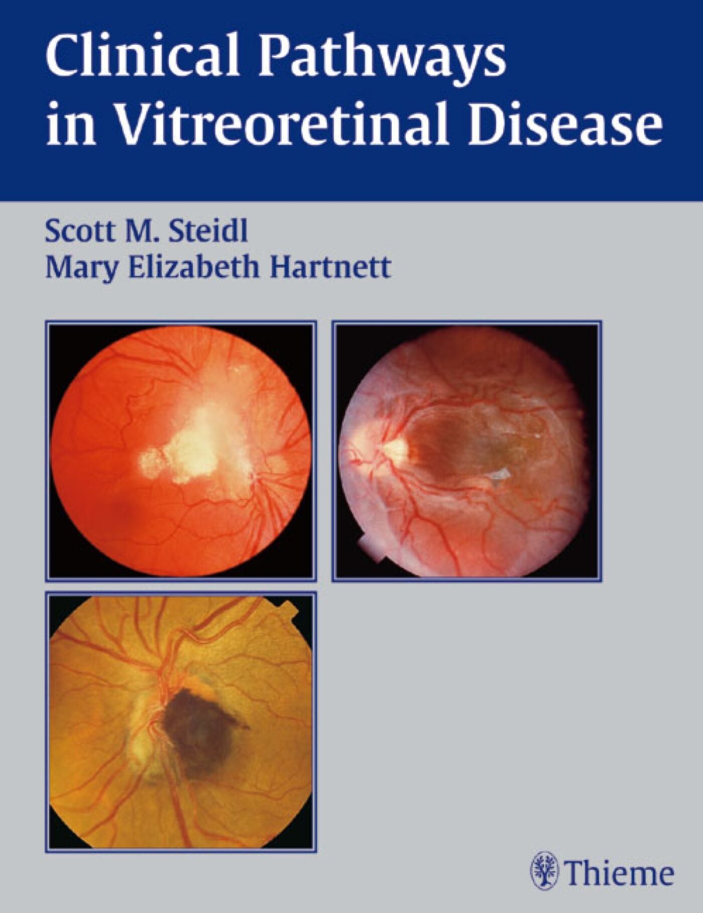 Clinical Pathways In Vitreoretinal Disease, 9781588901194