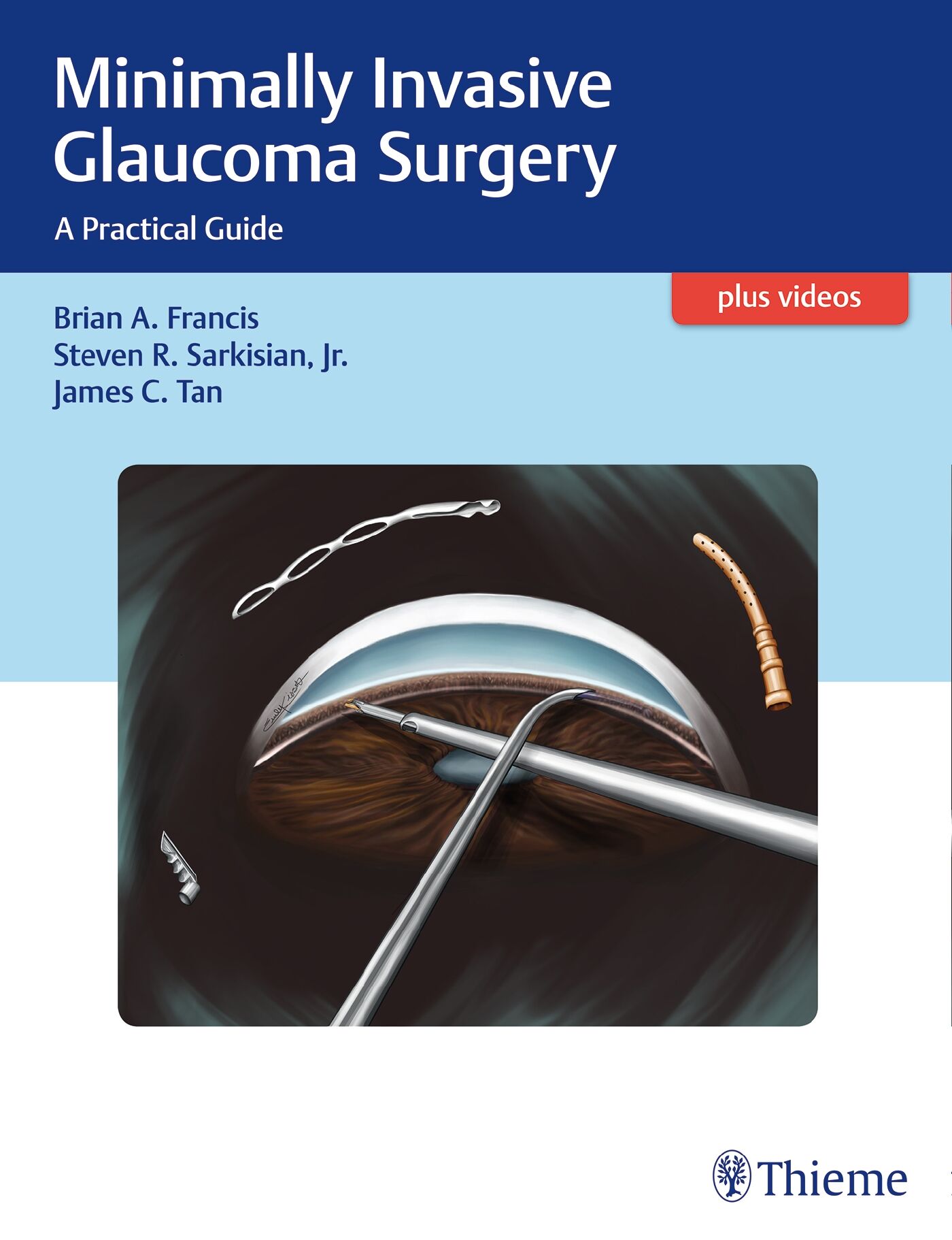Minimally Invasive Glaucoma Surgery, 9781626231566