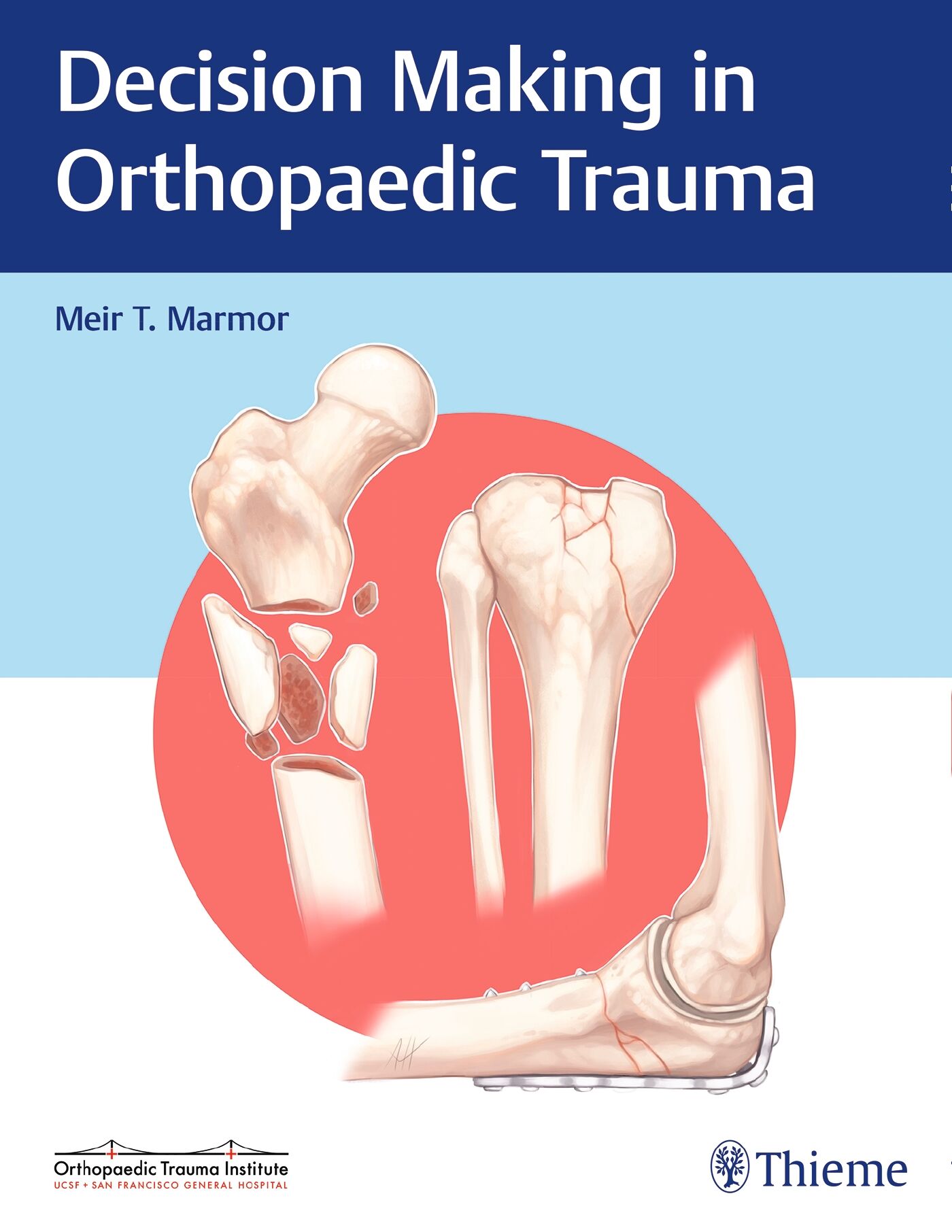 Decision Making in Orthopaedic Trauma, 9781626234611