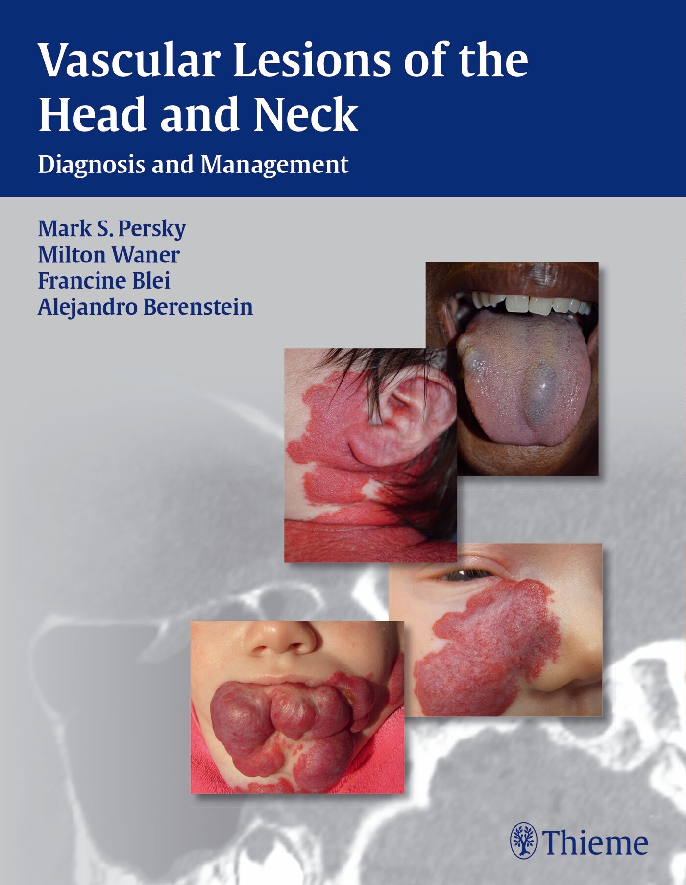 Vascular Lesions of the Head and Neck, 9781604060591