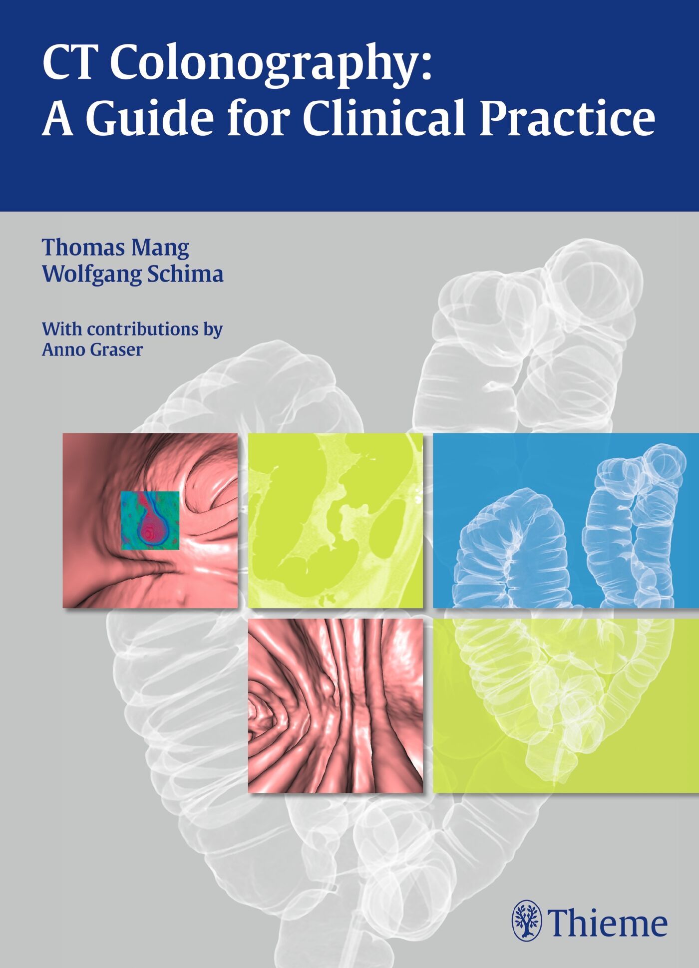 CT Colonography: A Guide for Clinical Practice, 9783131472618