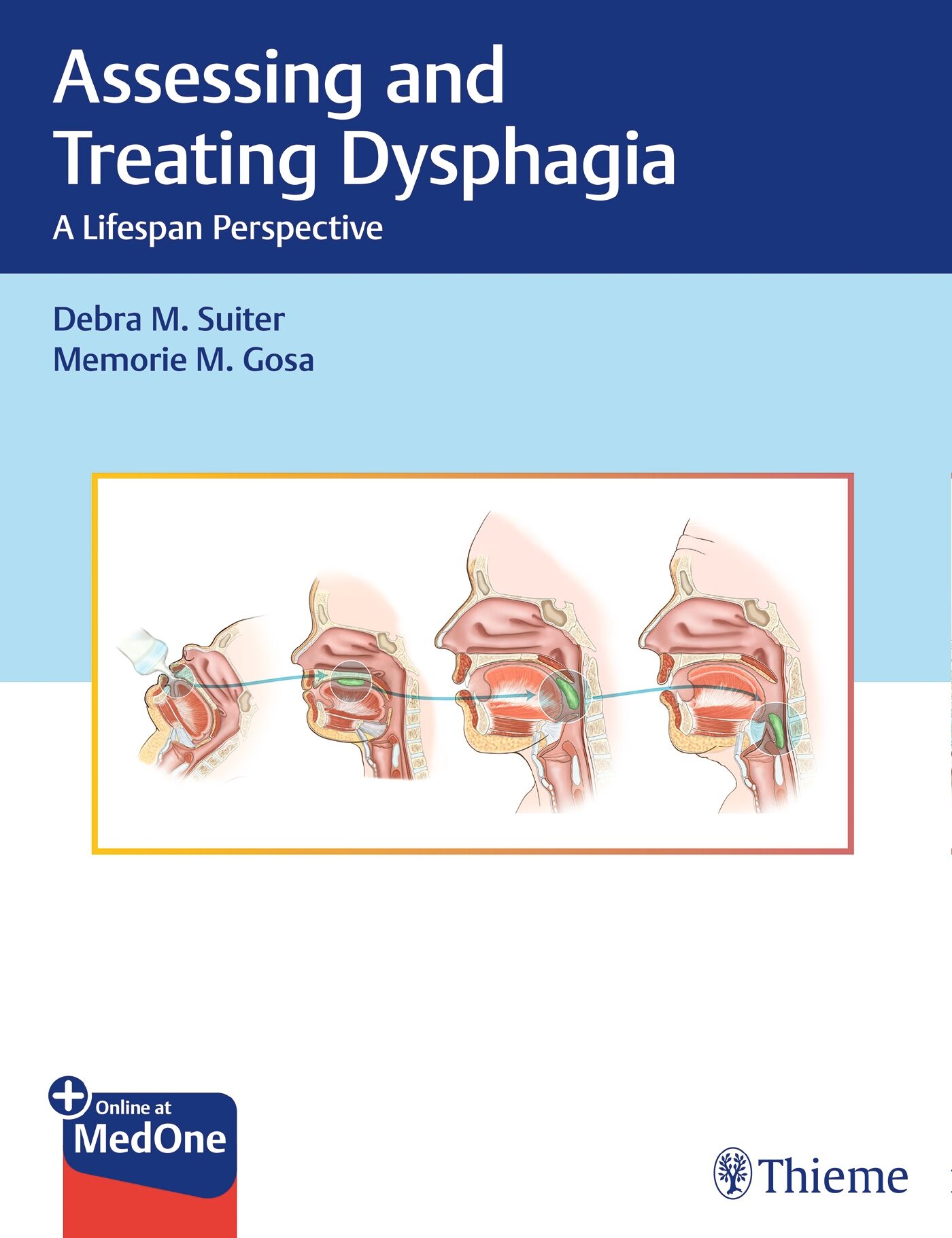 Assessing and Treating Dysphagia, 9781626232150