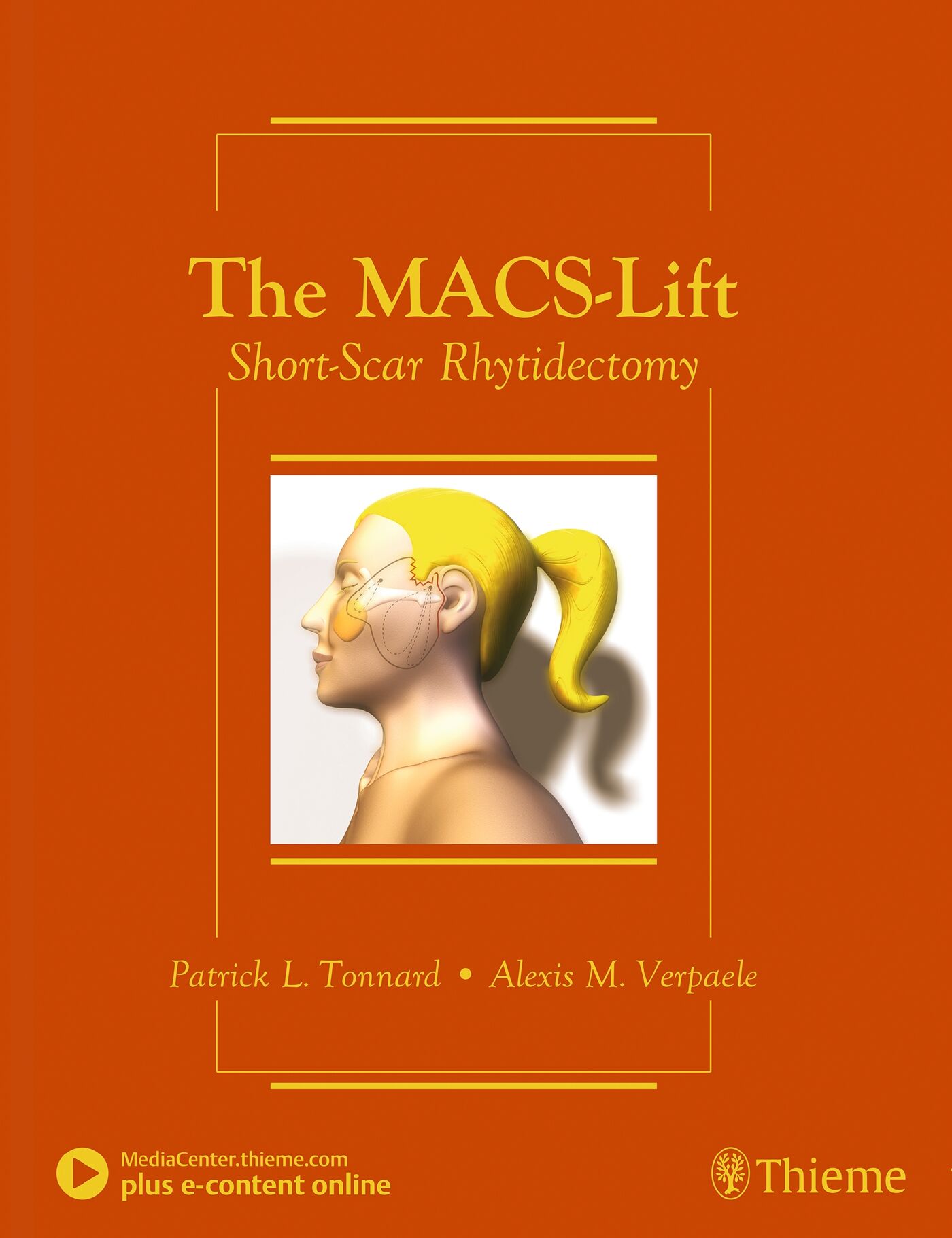 The MACS-Lift, 9781626236332