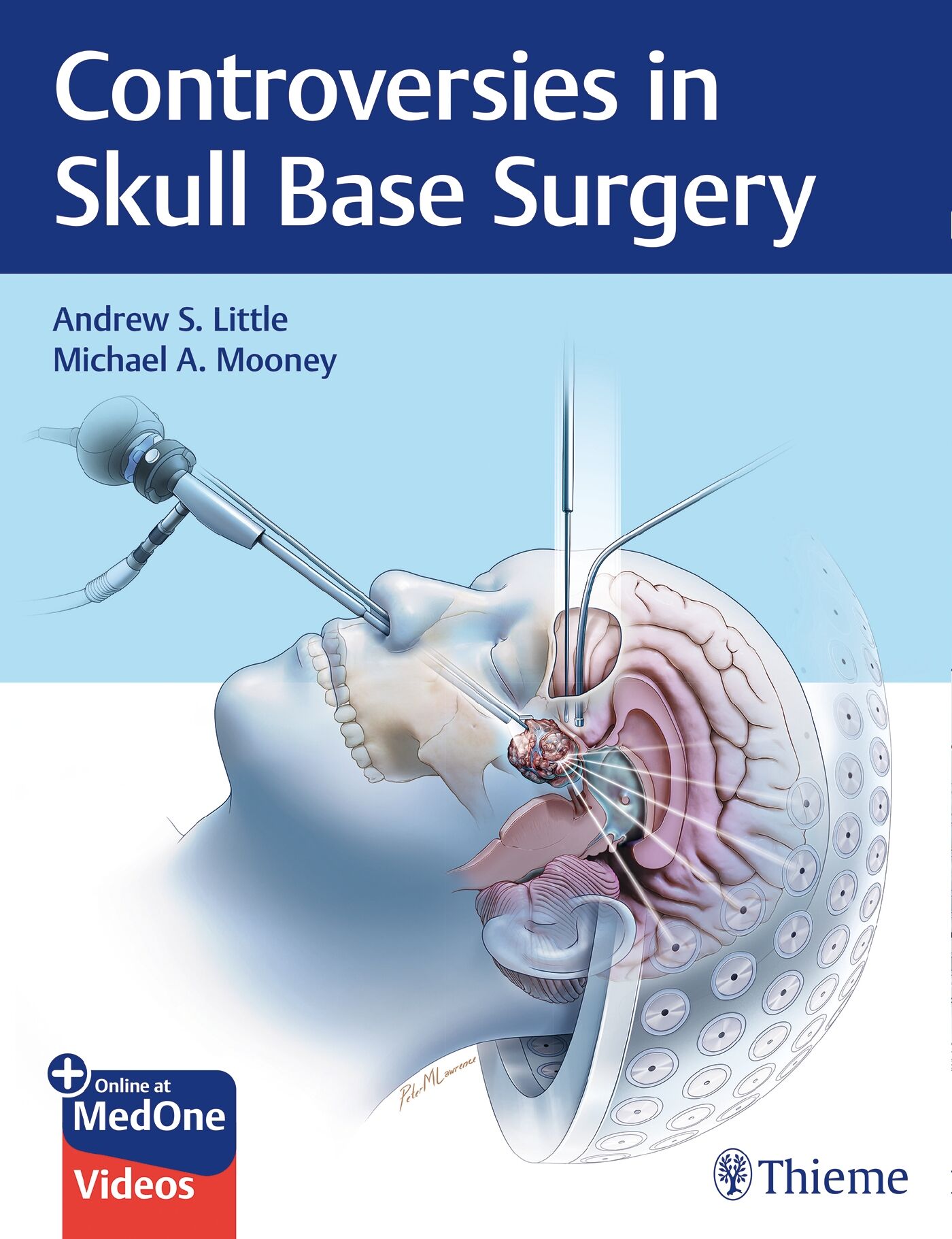 Controversies in Skull Base Surgery, 9781626239531
