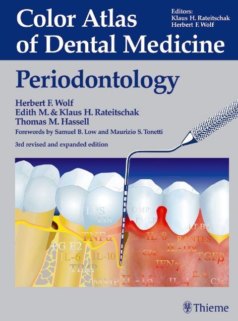 Color Atlas of Dental Medicine: Periodontology, 9783136750032